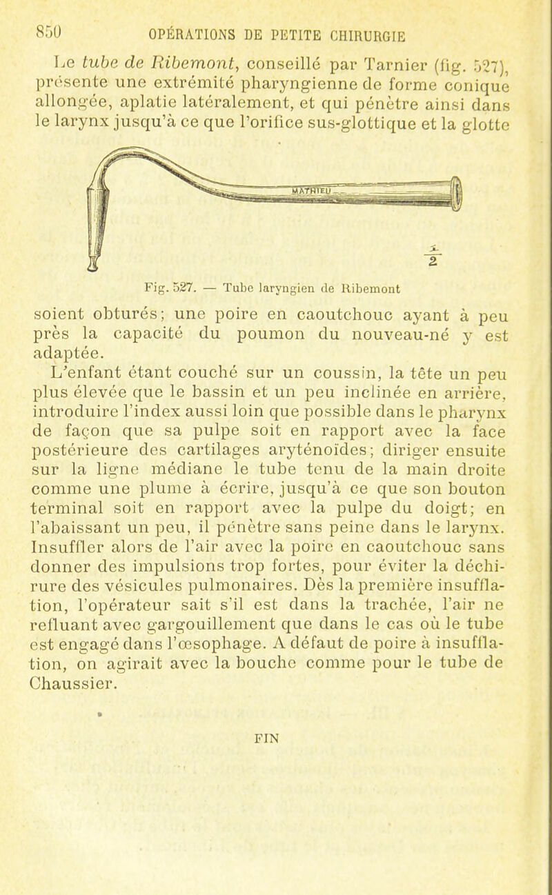Le tube de Ribemont, conseillé par Tarnier (fig. 527), prosente une extrémité pharyngienne de forme conique allongée, aplatie latéralement, et qui pénètre ainsi dans le larynx jusqu'à ce que l'orifice sus-glottique et la glotte Fig. 527. — Tube laryngien de Ribemont soient obturés; une poire en caoutchouc ayant à peu près la capacité du poumon du nouveau-né y est adaptée. L'enfant étant couché sur un coussin, la tête un peu plus élevée que le bassin et un peu inclinée en arrière, introduire l'index aussi loin que possible dans le pharynx de façon que sa pulpe soit en rapport avec la face postérieure des cartilages aryténoïdes; diriger ensuite sur la ligne médiane le tube tenu de la main droite comme une plume à écrire, jusqu'à ce que son bouton terminal soit en rapport avec la pulpe du doigt; en l'abaissant un peu, il pénètre sans peine dans le larynx. Insuffler alors de l'air avec la poire en caoutchouc sans donner des impulsions trop fortes, pour éviter la déchi- rure des vésicules pulmonaires. Dès la première insuffla- tion, l'opérateur sait s'il est dans la trachée, l'air ne refluant avec gargouillement que dans le cas où le tube est engagé dans l'œsophage. A défaut de poire à insuffla- tion, on agirait avec la bouche comme pour le tube de Chaussier. FIN