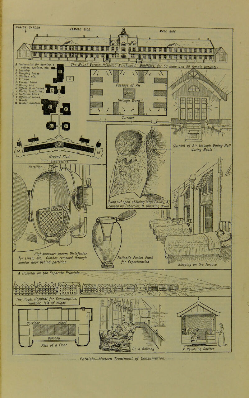 WimCR 04I)D£M JL_ MAL£ aiD£ A Incinerator for burning ^ refuse, sputum, etc. B Laundry C Pumping house 0 Stables, etc E Kitchen F- Nurses' home 0 Dining hall H Offices A entrance 1 Baths, lauatories.. J Isolation block K Officials' rooms L Wards I M Winter Gardens^ The Mount Vernon HosaitarNorthumod. Middfesex. fgf SQ Phthisis—Modern Treatment of Consumption.