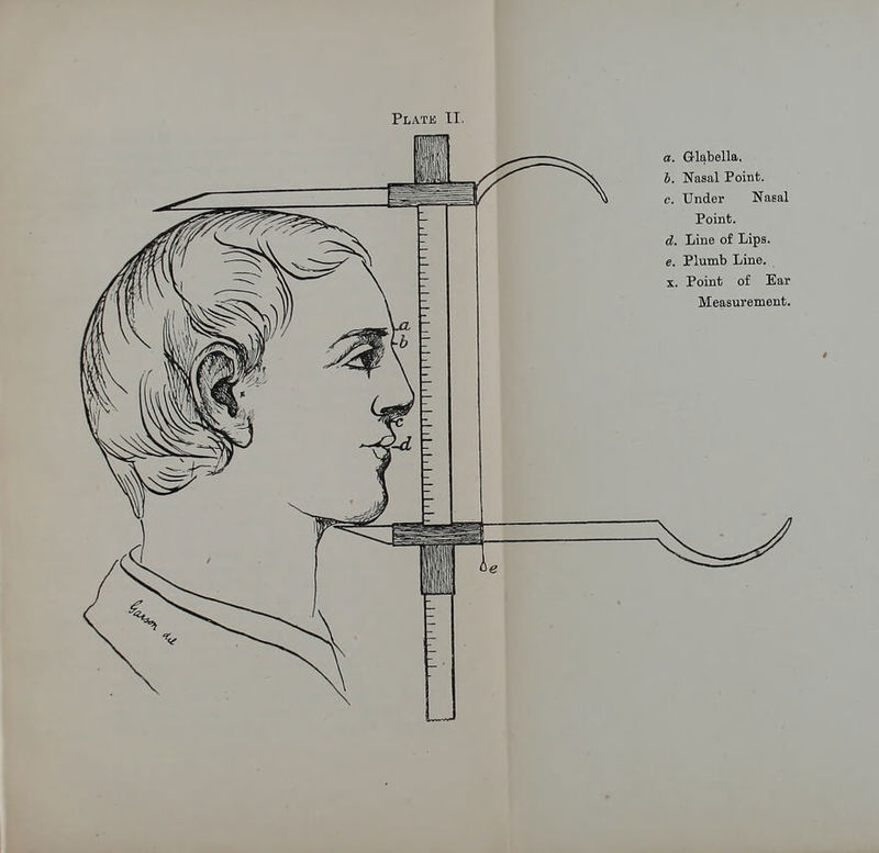 Q-labella. Nasal Point. c. Under Nasal Point. d. Line of Lips. e. Plumb Line. Point of Ear Measurement.
