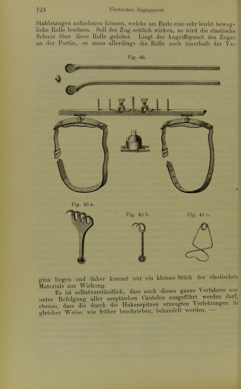 Stahlstailgen aulhelimen können, welche am Ende eine sehr leicht bewe<(- liche Rolle besitzen. Soll der Zug seitlich wirken, so wird die elastische Schimr über diese Rolle geleitet. Liegt der Angriffspunct des Zuges an der Portio, so nniss allerdings die Rolle noch innerhalb der Va- Fig. 46. Fig. 46 a. Fig. 46 b. Fig. 46 c. gina liegen und daher kommt nur ein kleines Stück des elastischen Materials zur Wirkung. tt r i. Es ist selbstverständlich, dass auch dieses ganze Verfahren nur unter Befolgung aller aseptischen Cautelen ausgeführt werden darf, ebenso, dass die durch die Hakenspitzen erzeugten Verletzungen m gleicher Weise, wie früher beschrieben, behandelt werden. —