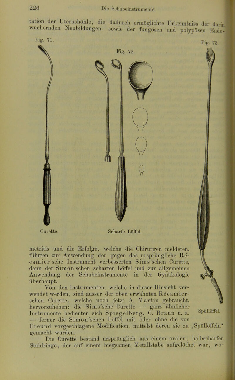 tation der Uterushöhle, die dadurch ermöglichte Erkenntniss der darin wuchernden Neubildungen, sowie der fungösen und polyxjösen Endo- Fig. 71. Fig. 73. Fig. 72. Curette. Scharfe Löffel. metritis und die Erfolge, welche die Chirurgen meldeten, führten zur Anwendung der gegen das ursprüngliche Re- camier'sche Instrument verbesserten Sims'sehen Curette, dann der Simon'schen scharfen Löffel und zur allgemeinen Anwendung der Schabeinstrumente in der Gynäkologie überhaupt. Von den Instrumenten, welche in dieser Hinsicht ver- wendet werden, sind ausser der oben erwähnten Recamier- schen Curette, welche noch jetzt A. Martin gebraucht, hervorzuheben: die Sims'sehe Curette — ganz ähnlicher Instrumente bedienten sich Spiegelberg, C. Braun u. a. — ferner die Simon'schen Löffel mit oder ohne die von Freund vorgeschlagene Modification, mittelst deren sie zu „Spüllöffehi gemacht wurden. Die Curette bestand ursprünglich aus einem ovalen, halbscharfeu Stahlringe, der auf einem biegsamen Metallstabe aufgelöthet war, wo- Spüllöffel.