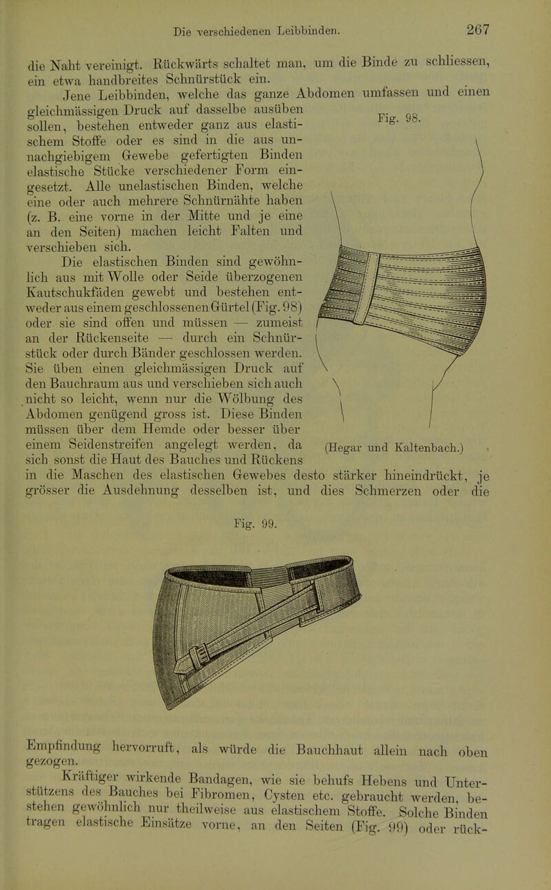 Fig. 98. die Naht vereinigt. Rückwärts schaltet man, um die Binde zu schliessen, ein etwa handbreites Schnürstück ein. Jene Leibbinden, welche das ganze Abdomen umfassen und emen gleichmässigen Druck auf dasselbe ausüben sollen, bestehen entweder ganz aus elasti- schem Stoffe oder es sind in die aus un- nachgiebigem Gewebe gefertigten Binden elastische Stücke verschiedener Form ein- gesetzt. Alle unelastischen Binden, welche eine oder auch mehrere Schnürnähte haben (z. B. eine vorne in der Mitte und je eine an den Seiten) machen leicht Falten und verschieben sich. Die elastischen Binden sind gewöhn- lich aus mit Wolle oder Seide überzogenen Kautschukfäden gewebt und bestehen ent- weder aus einem gesclilossenen Grürtel (Fig. 98) oder sie sind offen und müssen — zumeist an der Rückenseite — durch ein Schnür- stück oder durch Bänder geschlossen werden. Sie üben einen gleichmässigen Druck auf den Bauchraum aus und verschieben sich auch nicht so leicht, wenn nur die Wölbung des Abdomen genügend gross ist. Diese Binden müssen über dem Hemde oder besser über einem Seidenstreifen angelegt werden, da sich sonst die Haut des Bauches und Rückens in die Maschen des elastischen Gewebes desto stärker hineindrückt, je grösser die Ausdehnung desselben ist, und dies Schmerzen oder die (Hegar und Kaltenbach.) Fig. 99. Empfindung hervorruft, als würde die Bauchhaut allein nach oben gezogen. Kräftiger wirkende Bandagen, wie sie behufs Hebens und Unter- stützens des Bauches bei Fibromen, Cysten etc. gebraucht werden be- stehen gewöhnhch nur theilweise aus elastischem Stoffe. Solche Binden tragen elastische Emsätze vorne, an den Seiten (Fig. 90) oder rück-