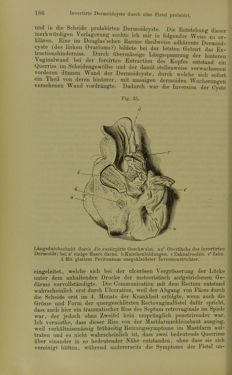 Invertirte Dermoidcyste durch eine Fistel prolabirt. und in die Scheide prolabirten Dermoidcyste. Die Entstehung dieser merkwürdigen Verlagerung suchte ich mir in folgender Weise zu er- klären. Eine im Douglas'schen Räume theilweise adhärente Dermoid- cyste (des linken Ovariums?) bildete bei der letzten Geburt das Ex- tractionshinderniss. Durch übermässige Längsspannung der hinteren Vaginalwand bei der forcirten Extraction des Kopfes entstand ein Querriss im Scheidengewölbe und der damit stellenweise verwachsenen vorderen dünnen Wand der Dermoidcyste, durch welche sich sofort ein Theil von deren hinterer, mit massigen dermoiden Wucherungen versehenen Wand vordrängte. Dadurch war die Inversion der Cyste Fig. 35. d Längsdurchschnitt durcli die exstirpirte Geschwulst, aa' Oberfläche des invertirten Dermoids'; bei a' einige Haare daran, b Knochenbildungen, c Zahnalveolen. c' Zahn, d Mit glattem Peritonäum ausgekleideter Inversionstrichter. eingeleitet, welche sich bei der ulcerösen Vergrösserung der Lücke unter dem anhaltenden Drucke der meteoristisch aufgetriebenen Ge- därme vervollständigte. Die Communication mit dem Rectum entstand wahrscheinlich erst durch Ulceration, weil der Abgang von Fäces durch die Scheide erst im 4. Monate der Krankheit erfolgte, wenn auch die Grösse und Form der quergeschlitzten Rectovaginalfistel dafür spricht, dass auch hier ein traumatischer Riss des Septum retrovaginale im Spiele war, der jedoch ohne Zweifel kein ursprünglich penetrirender war. Ich vermuthe, dass dieser Riss von der Mastdavmschleimhaut ausging, weil verhältnissmässig frühzeitig Reizungssymptome im Mastdarm auf- traten und es nicht wahrscheinlich ist, dass zwei bedeutende Querrisse über einander in so bedeutender Nähe entstanden, ohne dass sie sich vereinigt hätten, während andererseits die Symptome der Fistel un-