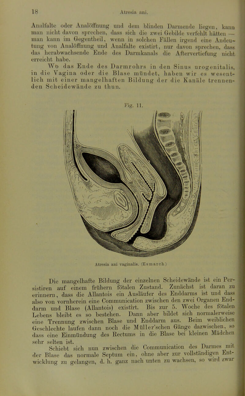 AimUalte oder Aiia]öffnun<^ und dem blinden Darniende liegen, kann man nicht davon sprechen, dass sich die zwei Gebilde verfehlt liätten — man kann im Gegentheil, wenn in solchen Fällen irgend eine Andeu- tung von Analöffnung und Analfalte existirt, nur davon sprechen, dass das herabwachsende Ende des Darmkanals die Aftervertiefung nicht erreicht habe. Wo das Ende des Darmrohrs in den Sinus urogenitalis» in die Vagina oder die Blase mündet, haben wir es wesent- lich mit einer mangelhaften Bildung der die Kanäle trennen- den Scheidewände zu thun. Fig. 11. Atresia ani vaginalis. (Esmarch.) Die mangelhafte Bildung der einzelnen Scheidewände ist ein Per- sistiren auf einem frühern fötalen Zustand. Zunächst ist daran zu erinnern, dass die Allantois ein Ausläufer des Enddarms ist und dass also von vornherein eine Communication zwischen den zwei Organen End- darm und Blase (Allantois) existirt. Bis zur 5. Woche des fötalen Lebens bleibt es so bestehen. Dann aber bildet sich normalerweise eine Trennung zwischen Blase und Enddarm aus. Beim weiblichen Geschlechte laufen dann noch die Müller'schen Gänge dazwischen, so dass eine Einmündung des Rectunis in die Blase bei kleinen Mädchen sehr selten ist. Schiebt sich nun zwischen die Communication des Darmes mit der Blase das normale Septum ein, ohne aber zur vollständigen Ent- wicklung zu gelangen, d. h. ganz nach unten zu wachsen, so wird zwar
