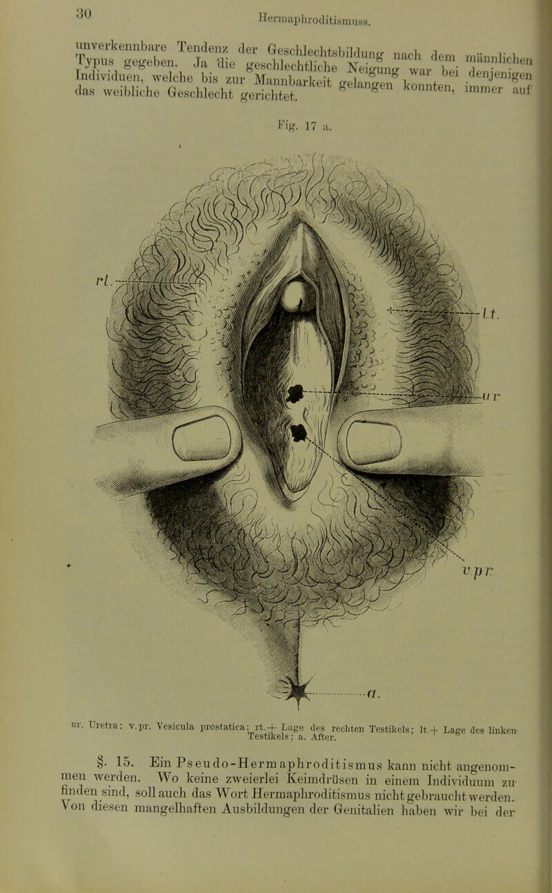 .e4e,f c:.et ä:? Fig. 17 a. - it. v.pr a. Uretia; v.pr. Vesicula prostatica; it.+ Lage des recliten Testikels; lt.+ Lage des linken- Testikels; a. After. §. 15. EinP seuclo-Hermaphroditismus kann nicht angenom- men werden. Wo keine zweierlei Keimdrüsen in einem Individuum zu finden smd, soll auch das Wort Hermaphroditismus nicht gebrauclit werden. Von diesen mangelhaften Ausbildungen der Genitalien haben wir bei der