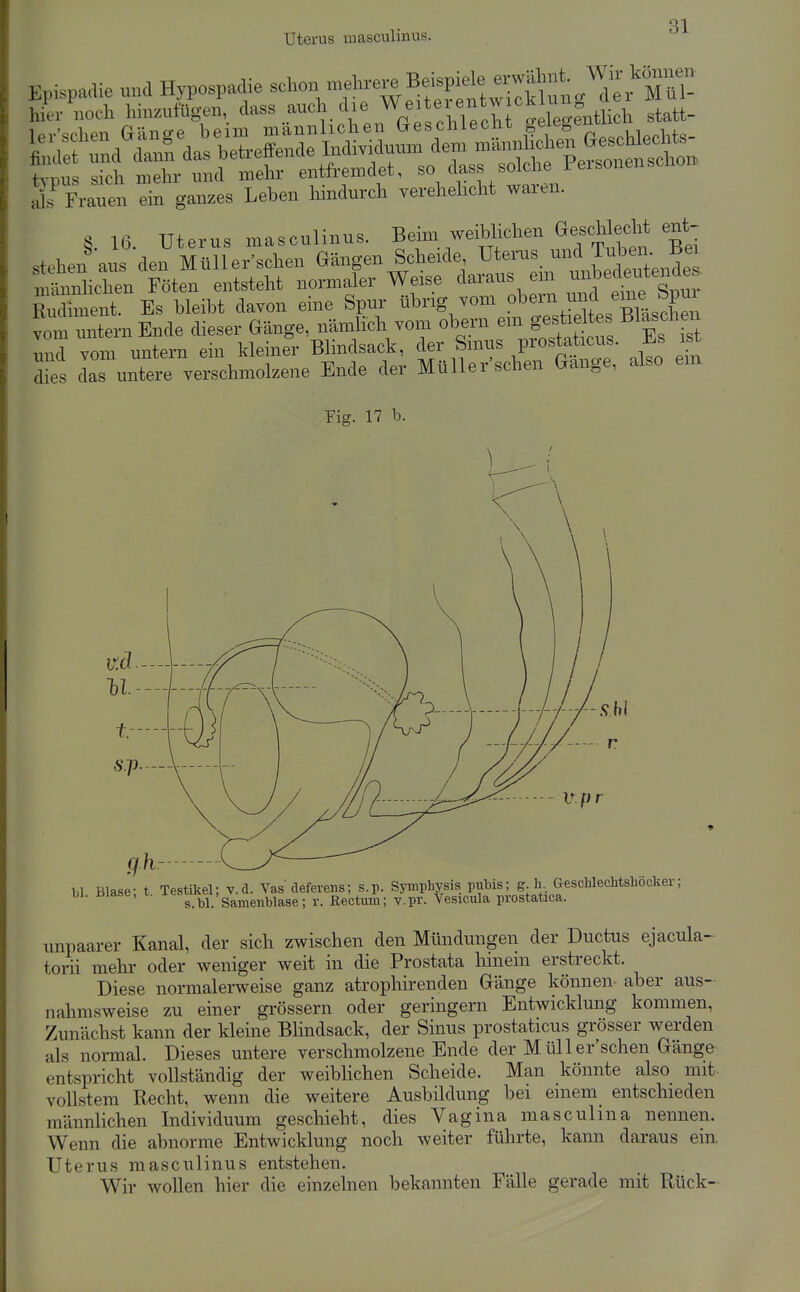 Uterus masculinus. Ss' Frauen n ganzes Leben hindnrch verehelicht waren. §. IC. Uterus masculinus. Beim weiblichen Geschlecht ent- und vom untern ein kleiner Blindsack, ^er ^nrns prosta^ic^^^^ Es is dies das untere verschmolzene Ende der Müller sehen Gange, also em Fig. 17 b. bl. Blase; t. Testikel; v.d. Vas deferens; s.p. Symphysis Pf 5 g; ^eschlechtshöcker; s.bl. Samenblase; v. Rectum; v.pr. Vesicula prostatica. unpaarer Kanal, der sich zwischen den Mündungen der Ductus ejacula- torii mehr oder weniger weit in die Prostata liineni erstreckt. Diese normalerweise ganz atrophirenden Gänge können- aber aus- nahmsweise zu einer grössern oder geringem Entwicklung kommen, Zunächst kann der kleine Blindsack, der Sinus prostaticus grösser werden als normal. Dieses untere verschmolzene Ende der MüUer'schen Gänge entspricht vollständig der weibhchen Scheide. Man könnte also mit vollstem Recht, wenn die weitere Ausbildung bei einem entschieden männlichen Individuum geschieht, dies Vagina masculina nennen. Wenn die abnorme Entwicklung noch weiter führte, kann daraus ein Uterus masculinus entstehen. Wir wollen hier die einzelnen bekannten Fälle gerade mit Rück-