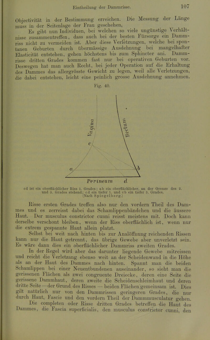 Eintheilung der Dammrisse. Objectivität in der Bestimmung erreichen. Die Messung der Länge muss in der Seitenlage der Frau geschehen, Es gibt nun Individuen, bei welchen so viele ungünstige Verhält- nisse zusammentreffen, dass auch bei der besten Fürsorge ein Damm- riss nicht zu vermeiden ist. Aber diese Verletzungen, welche bei spon- tanen Geburten durch übermässige Ausdehnung bei mangelhafter Elasticität entstehen, gehen höchstens bis zum Sphincter ani. Damm- risse dritten Grades kommen fast nur bei operativen Geburten vor. Deswegen hat man auch Recht, bei jeder Operation auf die Erhaltung des Dammes das allergrösste Gewicht zu legen, weil alle Verletzungen, die dabei entstehen, leicht eine peinhch grosse Ausdehnung annehmen. Fig. 40. Ferineum d cd ist ein oberfläclilicher Riss 1. Grades; ab ein obei'fläcMiclier, an der Grenze des 2. und 3. Grades stehend; cd ein tiefer l. und ob ein tiefer 3. Grades. (Nach Spiegelberg.) Risse ersten Grades treffen also nur den vordem Theil des Dam- mes und es zerreisst dabei das Schamlippenbändchen und die äussere Haut. Der musculus constrictor cunni reisst meistens mit. Doch kann derselbe verschont bleiben, wenn der Riss oberflächlich ist, wenn nur die extrem gespannte Haut allein platzt. Selbst bei weit nach hinten bis zur Analöfifnung reichenden Rissen kann nur die Haut getrennt, das übrige Gewebe aber unverletzt sein. Es wäre dann dies ein oberflächlicher Dammriss zweiten Grades. In der Regel wird aber das darunter liegende Gewebe mitreissen und reicht die Verletzang ebenso weit an der Scheidenwand in die Höhe als an der Haut des Dammes nach hinten. Spannt man die beiden Schamlippen bei einer Neuentbundenen auseinander, so sieht man die gerissenen Flächen als zwei congruente Dreiecke, deren eine Seite die gerissene Dammhaut, deren zweite die Scheidenschleimhaut und deren dritte Seite —der Grund des Risses — beiden Flächen gemeinsam ist. Dies gilt natürlich nur von den Dammrissen geringeren Grades, die nur durch Haut, Fascie und den vordem Theil der Dammmusculatur gehen. Die completen oder Risse dritten Grades betreffen die Haut des Dammes, die Fascia superficialis, den musculus constrictor cunni, den