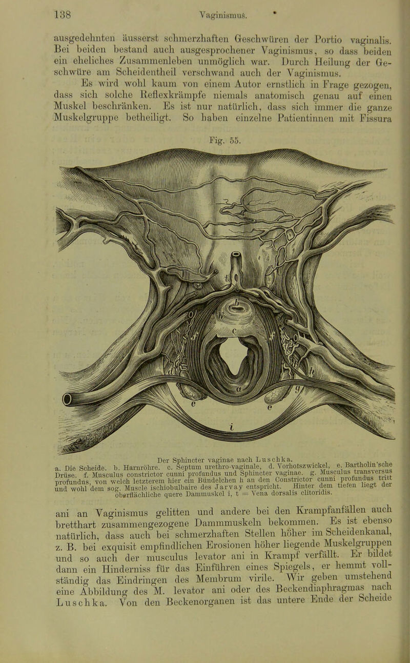 ausgedehnten äusserst schmerzhaften Gleschw Liren der Portio vaginahs. Bei beiden bestand auch ausgesprochener Vaginismus, so dass beiden ein eheliches Zusammenleben unmöglich war. Durch Heilung der Ge- schwüre am Scheidentheil verschwand auch der Vaginismus. Es wird wohl kaum von einem Autor ernstlich in Frage gezogen, dass sich solche Reflexkrämpfe niemals anatomisch genau auf einen Muskel beschränken. Es ist nur natürlich, dass sich immer die ganze Muskclgruppe betheiligt. So haben einzelne Patientinnen mit Fissura Fig. 55. Der Sphincter vagiiiae nach Luschka. t> i.,, v , i a. Die Scheide, b. Harnröhre, c. Septum urethro-vaginale, d. Vorhotszwickel, e Bartholm sehe Drüse, f. Musculus constrictor cuuni profundus und Sphincter yaginae. g. Musculus tians\ersus profundus, von welch letzterem hier ein Bündelchen h an den Constrictor und wohl dem sog. Muscle ischiobulbaire des Jarvay entspricht. ^Hinter dem tiefen liegt der oberflächliche quere Dammuskel i, t = Vena dorsalis clitoridis. ani an Vaginismus gelitten und andere bei den Krampfanfällen auch bretthart zusammengezogene Dammmuskeln bekommen. Es ist ebenso natürlich, dass auch bei schmerzhaften Stellen höher im Scheidenkanal, z. B. bei exquisit empfindlichen Erosionen höher liegende Muskelgruppen und so auch der musculus levator ani in Ki-ampf verfällt. Er büdet dann ein Hinderniss für das Einführen eines Spiegels, er hemmt voll- ständig das Eindringen des Membrum virile. Wir geben umstehend eine Abbildung des M. levator ani oder des Beckendmphragmas nacü Luschka. Von den Beckenorganen ist das untere Ende der Scheide