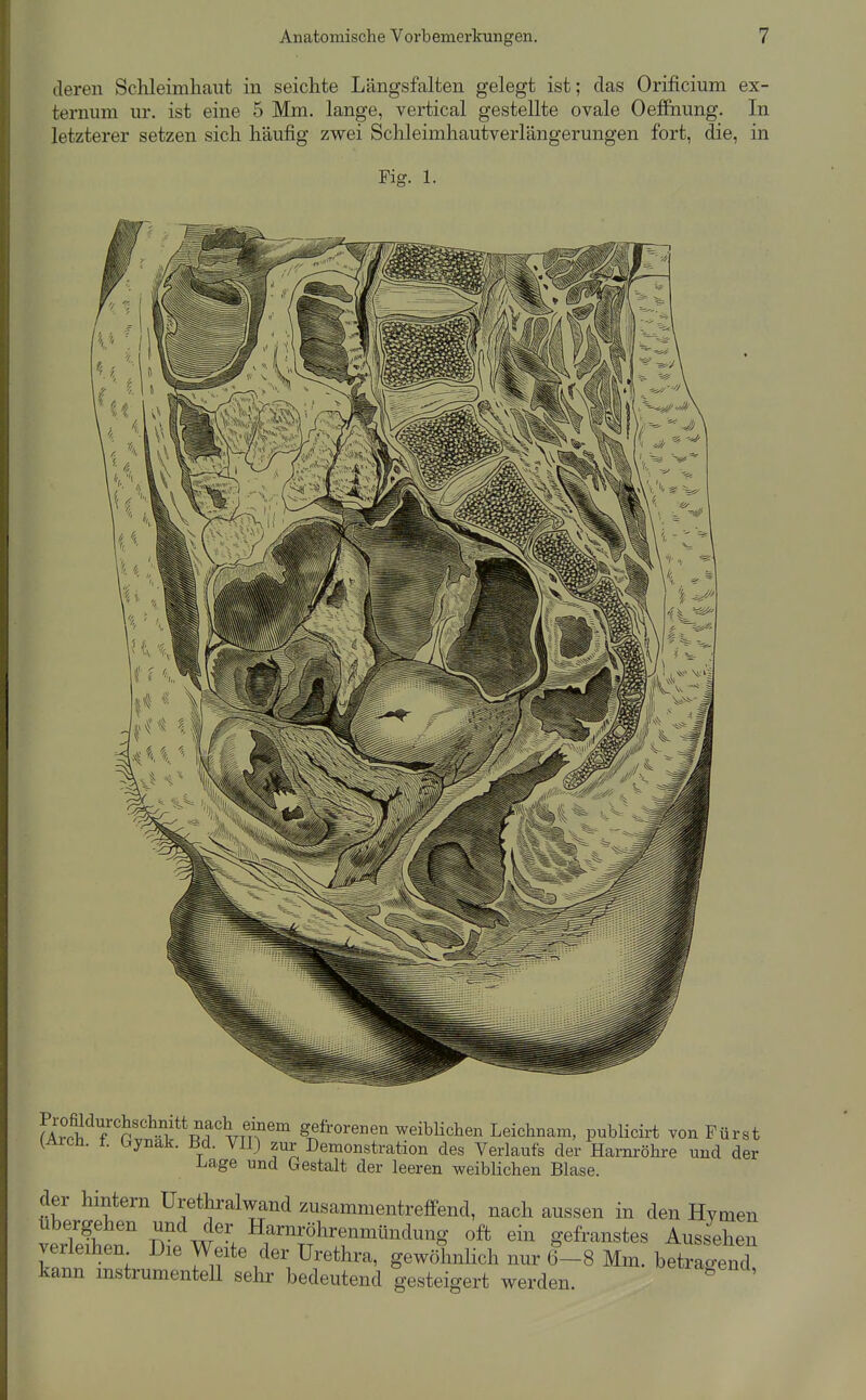 deren Schleimhaut in seichte Längsfalten gelegt ist; das Orificium ex- ternum ur. ist eine 5 Mm. lange, vertical gestellte ovale Oeffnung. In letzterer setzen sich häufig zwei Schleimhautverlängerungen fort, die, in Fig. 1. fA7ch'^y'S\''rvn^'' Seüoreuen weiblichen Leichnam, publicirt von Fürst (Aich. t. bynak. Bd. VII) zur Demonstration des Verlaufs der Harnröhre und der l^age und Gestalt der leeren weiblichen Blase. der hintern Urethralwand zusammentreffend, nach aussen in den Hymen verleihen Die Weite der Urethra, gewöhnlich nur 6-8 Mm. betragend kann mstrumenteU sehr bedeutend gesteigert werden. ^ '