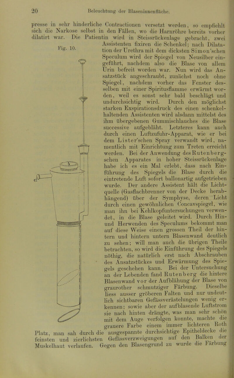 Fig. 10. Y ci presse in selir hinderliche Contractionen versetzt werden, so em])fiehlt sich die Narkose selbst in den Fällen, wo die Harnröhre liereits vorher dilatirt war. Die Patientin wird in Steissrückenlage gebracht, zwei Assistenten fixiren die Schenkel; nach Dilata- tion der Urethra mit dem dicksten Simon'sehen Speculmn wird der Spiegel von Neusilber ein- geführt, nachdem also die Blase von allem Urin befreit worden war. Nun wird das An- satzstück angeschraubt, zunächst noch ohne Spiegel, nachdem vorher das Fenster des-, selben mit einer Spiritusflamme erwärmt wor- den, weil es sonst sehr bald beschlägt und undurchsichtig wird. Durch den möglichst starken Exspirationsdruck des einen schenkel- haltenden Assistenten wird alsdann mittelst des ihm übergebenen Gummischlauches die Blase successive aufgebläht. Letzteres kann auch durch einen Luftzufuhr-Apparat, wie er bei dem Lister'schen Spray verwandt wird, na- mentlich mit Einrichtung zum Treten erreicht werden. Bei der Anwendung des R u t e n b e r g- schen Apparates in hoher Steissrückenlage habe ich es ein Mal erlebt, dass nach Ein- führung des Spiegels die Blase durch die eintretende Luft sofort ballonartig aufgetrieben wurde. Der andere Assistent hält die Licht- quelle (Gasflachbrenner von der Decke herab- hängend) über der Symphyse, deren Licht durch einen gewöhnlichen Concavspiegel, wie man ihn bei Kehlkopfuntersuchungen verwen- det, in die Blase geleitet wird. Durch Hin- und Herwenden des Speculums bekommt man auf diese Weise einen grossen Theil der hin- tern und hintern untern Blasenwand deutlich zu sehen; will man auch die übrigen Theile betrachten, so wird die Einführung des Spiegels nöthig, die natürlich erst nach Abschrauben des Ansatzstückes und Erwärmung des Spie- gels geschehen kann. Bei der Untersuchung an der Lebenden fand Rutenberg die hintere Blasenwand vor der Aufblähung der Blase von graurother schmutziger Färbung. Dieselbe Hess ausser gröberen Falten und nur undeut- lich sichtbaren Gefässverästelungeu wenig er- kennen; sowie aber der aufblasende Luftstrora sie nach hinten drängte, was man sehr schön mit dem Auge verfolgen konnte, machte die o-rauere Farbe einem immer lichteren Roth Platz, man sah durch dieausgespannte durchsichtige Epitlieldecke die feinsten und zierlichsten Gefössverzweigungen auf den Balken der Muskelhaut verlaufen. Gegen den Blasengrund zu wurde die J<arbung r