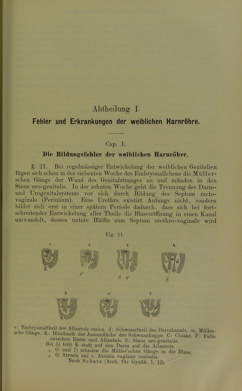 Abtheilung 1. Fehler und Erkrankungen der weiblichen Harnröhre. Cap. I. Die Bildungsfehler der weiblichen Harnröhre. §. 21. Bei regelmässiger Entwickelung der weibliclien Genitalien fügen sicli schon in der siebenten Woclie des Embryonallebens die MüUer- sclien Gänge der Wand des Genitalstranges an und münden in den Sinus uro-genitaHs. In der zehnten Woche geht die Trennung des Darm- und Urogenitalsystems vor sich durch Bildung des Septum recto- vaginale (Perinäum). Eine Urethra existirt Anfangs nicht, sondern bildet sich erst in einer spätem Periode dadurch, dass sich bei fort- schreitender Entwickelung aller Theile die Blasenöffnung in einen Kanal umwandelt, dessen untere Hälfte zum Septum urethro-vaginale wird Fig. 11. Z 3 V d: Schwanztheil des Darmkaaals. m: Müller- scnei^ange. K: Blindsack der Aussenfläche der Schwanzkappe. C: Cloake F- Falte zwischen Darm und AUantois. S: Sinus uro-genitalis. Bei 5) tntt K statt auf den Darm auf die AUantois.  R\ a*^ '^^ inünden die Müller'schen Gänge in die Blase. „ 6) Atresia ani c. Atresia vaginae vesicalis. Nach Schatz (Arch. für Gynäk. I, 12).