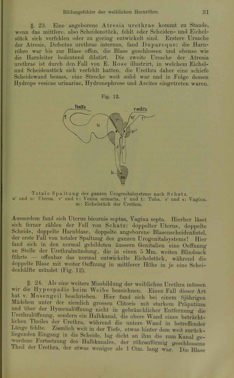 §. 23. Eine angeborene Atresia urethrae kommt zu Stande, wenn das mittlere, also Scheidenstück, felilt oder Scheiden- und Eichel- stück sich verfehlen oder zu gering entwickelt sind. Erstere Ursache der Atresie, Defectus urethrae internus, fand Duparcque: die Harn- röhre war bis zur Blase offen, die Blase geschlossen und ebenso wie die Harnleiter bedeutend dilatirt. Die zweite Ursache der Atresia urethrae ist durch den Fall von E. Rose illustrirt, in welchem Eichel- und Scheidenstück sich verfehlt hatten, die Urethra daher eine schiefe Scheidewand besass, eine Strecke weit solid war und in Folge dessen Hydrops vesicae urinariae, Hydronephrose und Ascites eingetreten waren. Fig. 12. Totale Spaltung des ganzen Urogenitalsystems nach Schatz, u' und u: Uterus, v' und v: Vesica urinaria. t' und t: Tuba, s' und s: Vagina. m: Eichelstück der Urethra. Ausserdem fand sich Uterus bicornis septus, Vagina septa. Hierher lässt sich ferner zählen der Fall von Schatz: doppelter Uterus, doppelte Scheide, doppelte Harnblase, doppelte angeborene Blasenscheidenfistel, der erste Fall von totaler Spaltung des ganzen Urogenitalsystems! Hier fand sich in den normal gebildeten äussern Genitalien eine Oeffinung an Stelle der Urethralmündung, die in einen 5 Mm. weiten Blindsack führte — offenbar das normal entwickelte Eichelstück, während die doppelte Blase mit weiter Oeffinung in mittlerer Höhe in je eine Schei- denhälfte mündet (Fig. 12). §. 24. Als eine weitere Missbildung der weiblichen Urethra müssen wir die Hypospadie beim Weibe bezeichnen. Einen Fall dieser Art hat V. Mosengeil beschrieben. Hier fand sich bei einem 8jährigen Mädchen unter der ziemlich grossen Clitoris mit starkem Präputium und über der Hymenalöffnung nicht in gebräuclilicher Entfernung die Urethralöffnung, sondern ein Halbkanal, die obere Wand eines beträcht- lichen Theües der Urethra, während die untere Wand in betreffender Länge fehlte. Ziemlich weit in der Tiefe, etwas hinter dem weit zurück- liegenden Emgang in die Scheide, lag dicht an ihm die zum Kanal ge- wordene Fortsetzung des Halbkanales, der röhrenförmig geschlossene Theil der Urethra, der etwas weniger als 1 Ctm. lang war. Die Blase