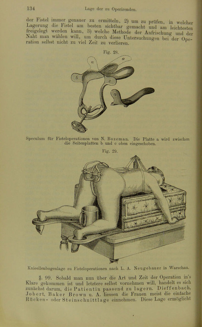 der Fistel immer genauer zu ermitteln, 2) um zu prüfen, in welcher Lagei-ung die Fistel am besten sichtbar gemacht und am leichtesten h-eigelegt werden kann, 3) welche Methode der Anfrischung und der Naht man wählen will, um durch diese Untersuchungen bei der Ope- ration selbst nicht zu viel Zeit zu verlieren. Fig. 28. Speculum für Fisteloperationen von N. Bozeman. Die Platte a wird zwischen die Seitenplatten b und c oben eingeschoben. Fig. 29. Knieellenbogenlage zu Fisteloperationen nach L. A. Neugebauer in Warschau. §. 99. Sobald man nun über die Art und Zeit der Operation in's Klare gekommen ist und letztere selbst vornehmen will, handelt es sich zunächst darum, die Patientin passend zu lagern. Dieffenbacli, Jobert, Baker Brown u. A. Hessen die Frauen meist die einfache Rücken- oder Steinschnittlage einnehmen. Diese Lage ermöglicht