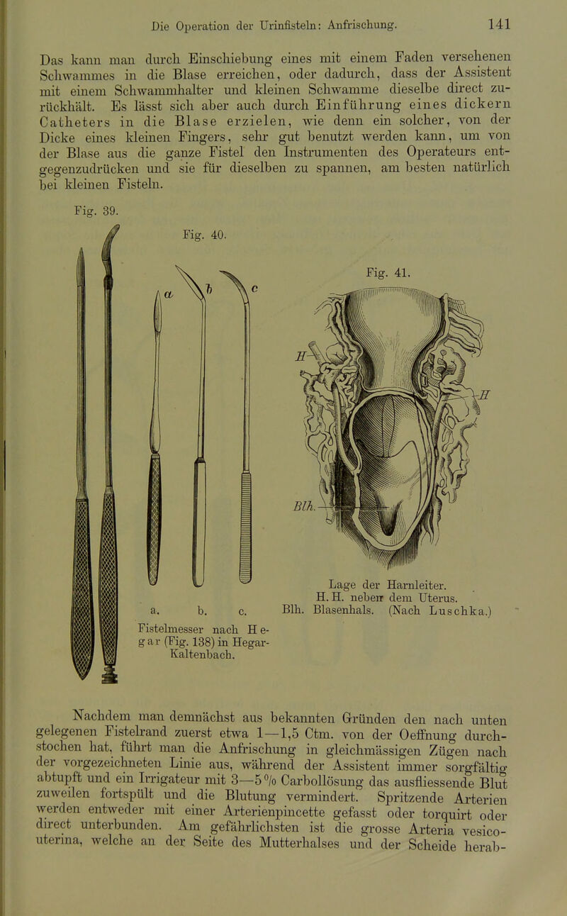 Das kann man durch Einscliiebung eines mit einem Faden versehenen Schwammes in die Blase erreichen, oder dadurch, dass der Assistent mit einem Schwammhalter und kleinen Schwämme dieselbe direct zu- rückhält. Es lässt sich aber auch durch Einführung eines dickern Catheters in die Blase erzielen, wie denn ein solcher, von der Dicke eines kleinen Fingers, sehr gut benutzt werden kann, um von der Blase aus die ganze Fistel den Instrumenten des Operateurs ent- gegenzudrücken und sie für dieselben zu spannen, am besten natürlich bei kleinen Fisteln. Fig. 39. Fig. 40. m m m w Fig. 41. a. b. c. Fistelmesser nach H e- gar (Fig. 138) in Hegar- Kaltenbach. Blh. Lage der Harnleiter. H.H. neben dem Uterus. Blasenhals. (Nach Luschka.) Nachdem man demnächst aus bekannten Gründen den nach unten gelegenen Fistelrand zuerst etwa 1—1,5 Ctm. von der Oefifnung durch- stochen hat, fülirt man die Anfrischung in gleichmässigen Zügen nach der vorgezeichneten Linie aus, während der Assistent immer sorgfältio- abtupft und ein Irrigateur mit 3—5% Carbollösung das ausfliessende Blut zuweüen fortspült und die Blutung vermindert. Spritzende Arterien werden entweder mit einer Arterienpincette gefasst oder torquirt oder direct unterbunden. Am gefährlichsten ist die grosse Arteria vesico- uterma, welche an der Seite des Mutterhalses und der Scheide herab-