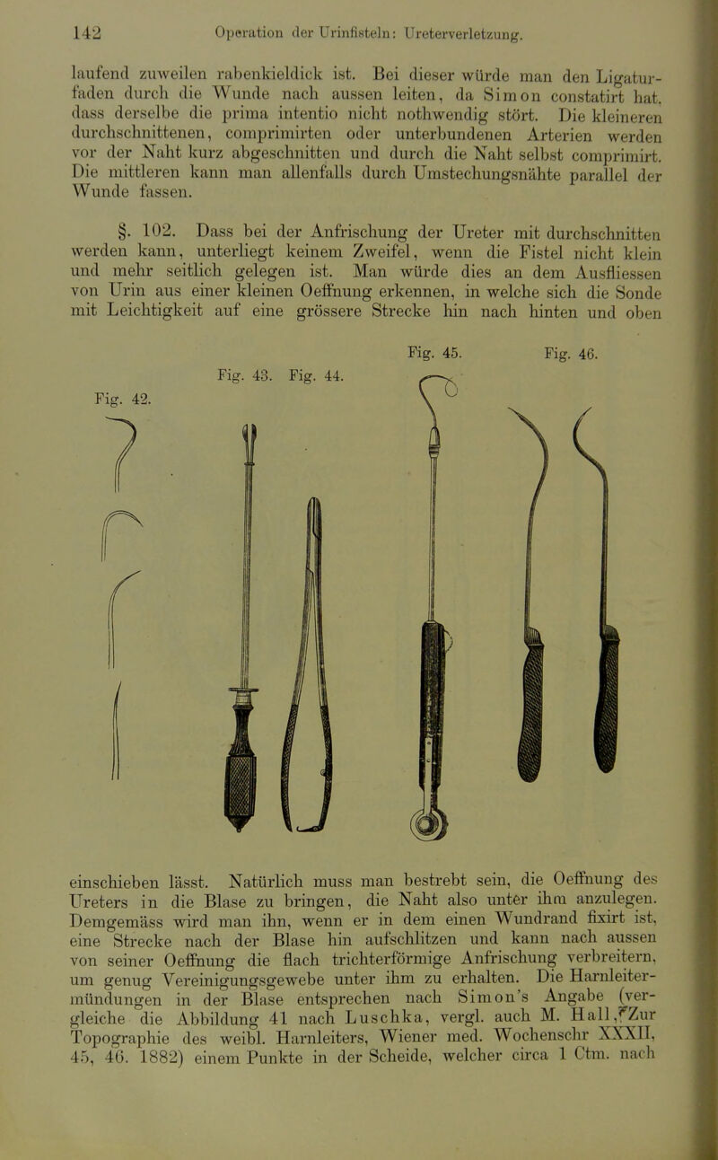 laufend zuweilen rabenkieldick ist. Bei dieser würde man den Ligatur- faden durch die Wunde nach aussen leiten, da Simon constatirt hat. dass derselbe die prima intentio nicht nothwendig stört. Die kleineren durchschnittenen, comprimirten oder unterbundenen Arterien werden vor der Naht kurz abgeschnitten und durch die Naht selbst comprimirt. Die mittleren kann man allenfalls durch Umstechungsnähte parallel der Wunde fassen. §. 102. Dass bei der Anfrischung der Ureter mit durchschnitten werden kann, unterliegt keinem Zweifel, wenn die Fistel nicht klein und mehr seitlich gelegen ist. Man würde dies an dem Ausfliessen von Urin aus einer kleinen Oeffnung erkennen, in welche sich die Sonde mit Leichtigkeit auf eine grössere Strecke hin nach hinten und oben Fig. 45. Fig. 46. einschieben lässt. Natürlich muss man bestrebt sein, die Oeffnung des Ureters in die Blase zu bringen, die Naht also unter ihm anzulegen. Demgemäss wird man ihn, wenn er in dem einen Wundrand fixii-t ist, eine Strecke nach der Blase hin aufschlitzen und kann nach aussen von seiner Oeffnung die flach trichterförmige Anfrischung verbreitern, um genug Vereinigungsgewebe unter ihm zu erhalten. Die Harnleiter- mündungen in der Blase entsprechen nach Simon's Angabe (ver- gleiche die Abbildung 41 nach Luschka, vergl. auch M. Hall,fZur Topographie des weibl. Harnleiters, Wiener med. Wochenschr XXXII, 45, 46. 1882) einem Punkte in der Scheide, welcher circa 1 Ctm. nach