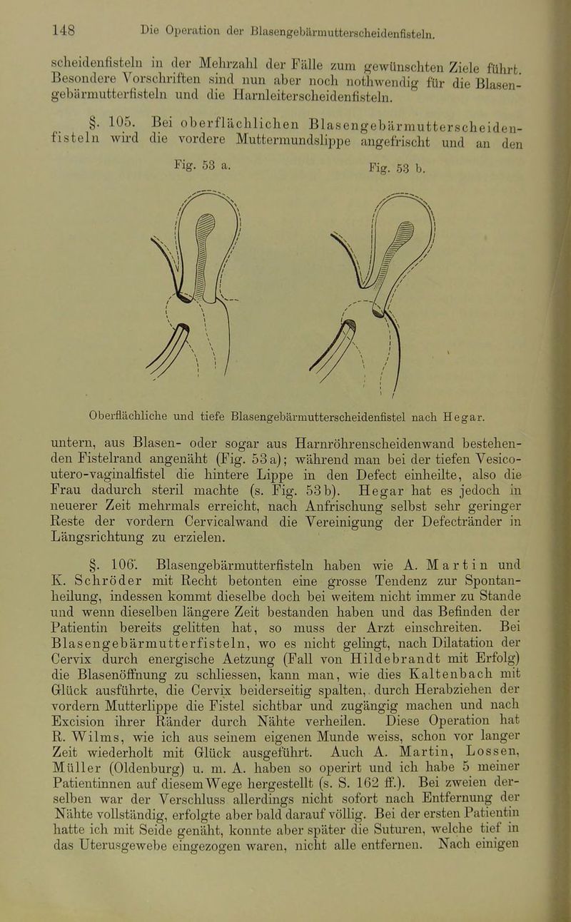 scheidenfisteln in der Mehrzahl der Fälle zum gewünschten Ziele führt Besondere Vorschriften sind nun aber noch nothwendig für die Blasen- gebärnmtterfisteln und die Harnleiterscheidenfisteln. §. 105. Bei oberflächlichen Blasengebärmutterscheiden- fisteln wird die vordere Muttermundslippe angefrischt und an den Fig. 53 a. Fig. 53 b. Oberflächliche und tiefe Blasengebärmutterscheidenfistel nach Hegar. untern, aus Blasen- oder sogar aus Harnröhrenscheidenwand bestehen- den Fistelrand angenäht (Fig. 53 a); während man bei der tiefen Vesico- utero-vaginalfistel die hintere Lippe in den Defect einheilte, also die Frau dadurch steril machte (s. Fig. 53b). Hegar hat es jedoch in neuerer Zeit mehrmals erreicht, nach Anfrischung selbst sehr geringer Reste der vordem Cervicalwand die Vereinigung der Defectränder in Längsrichtung zu erzielen. §. 106'. Blasengebärmutterfisteln haben wie A. Martin und K. Schröder mit Recht betonten eine grosse Tendenz zur Spontan- heilung, indessen kommt dieselbe doch bei weitem nicht immer zu Stande und wenn dieselben längere Zeit bestanden haben und das Befinden der Patientin bereits gelitten hat, so muss der Arzt einschreiten. Bei Blasengebärmutterfisteln, wo es nicht gelingt, nach Dilatation der Cervix durch energische Aetzung (Fall von Hildebrandt mit Erfolg) die Blasenöffnung zu scliliessen, kann man, wie dies Kaltenbach mit Glück ausführte, die Cervix beiderseitig spalten,. durch Herabziehen der vordem Mutterlippe die Fistel sichtbar und zugängig machen und nach Excision ihrer Ränder durch Nähte verheilen. Diese Operation hat R. Wilms, wie ich aus seinem eigenen Munde weiss, schon vor langer Zeit wiederholt mit Glück ausgeführt. Auch A. Martin, Lossen, Müller (Oldenburg) u. m. A. haben so operirt und ich habe 5 meiner Patientinnen auf diesem Wege hergestellt (s. S. 162 ff.). Bei zweien der- selben war der Verschluss allerdings nicht sofort nach Entfernung der Nähte vollständig, erfolgte aber bald darauf völlig. Bei der ersten Patientin hatte ich mit Seide genäht, konnte aber später die Suturen, welche tief in das Uterusgewebe eingezogen waren, nicht alle entfernen. Nach einigen