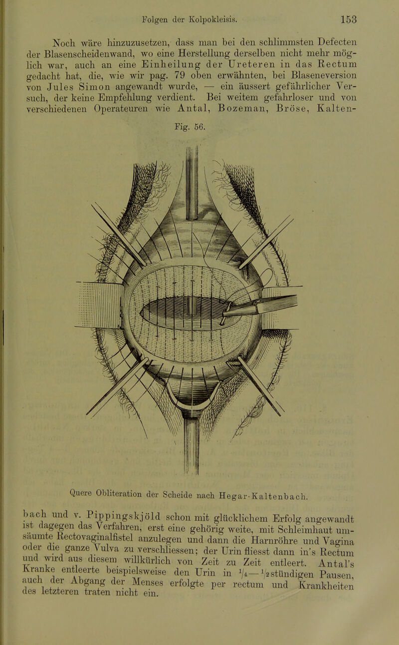 Noch wäre hinzuzusetzen, dass man bei den schlimmsten Defecten der Blasenscheidenwand, wo eine Herstellung derselben nicht mehr mög- lich war, auch an eine Einheilung der Ureteren in das Rectum gedacht hat, die, wie wir pag. 79 oben erwähnten, bei Blaseneversion von Jules Simon angewandt wurde, — ein äussert gefährlicher Ver- such, der keine Empfehlung verdient. Bei weitem gefahrloser und von verschiedenen Operateuren wie Antal, Bozeman, Bröse, Kalten- Fig. 56. Quere Obliteration der Scheide nach Hegar-Kaltenbach. bach und v Pippingskjöld schon mit glücklichem Erfolg angewandt ist dagegen das Verfahren, erst eine gehörig weite, mit Sclileimhaut um- säumte Kectovagmalfistel anzulegen und dann die Harnröhre und Vagina oder die ganze Vulva zu verschliessen; der Urin fliesst dann ins Rectum und wird aus diesem wülkürHch von Zeit zu Zeit entleert. Antal's Kranke entleerte beispielsweise den Urin in V*-1/2 stündigen Pausen auch der Abgang der Menses erfolgte per rectum und Krankheiten des letzteren traten nicht ein.