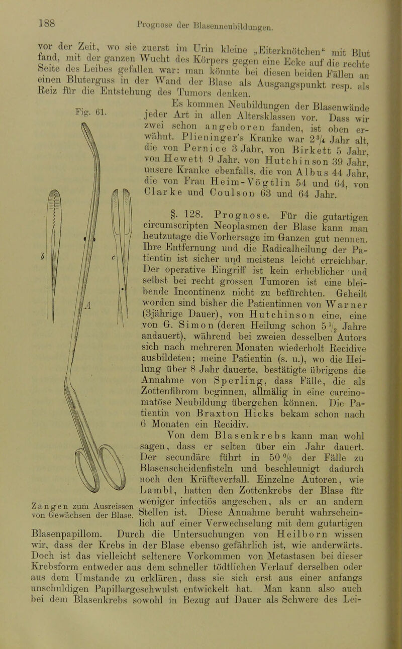 Fig. Ol. Ä vor der Zeit, wo sie zuei-st im Urin kleine „Eiterknötchen mit Blut iand, mit der ganzeii Wucht des Körpers gegen eine Ecke auf die rechte beite des Leibes gefallen war: man Idinnte bei diesen beiden Fällen an einen Blu erguss m der Wand der Blase als Ausgangspunkt resp. als Keiz lur die Entstehung des Tumors denken. ^ ° ^ i _ Es kommen Neubildungen der Blasenwände jeder Art m allen Altersklassen vor. Dass wir zwei schon angeboren fanden, ist oben er- wähnt. Plieninger's Kranke war 2^/4 Jahr alt die von Pernice 3 Jahr, von Birkett 5 Jahr, von Hewett 9 Jahr, von Hutchinson 39 Jahr,' unsere Kranke ebenfalls, die von Albus 44 Jahr,' die von Frau Heim-Vögtlin 54 und 64, von Clarke und Coulson 63 und 64 Jahr. §. 128. Prognose. Für die gutartigen circumscripten Neoplasmen der Blase kann man heutzutage die Vorhersage im Ganzen gut nennen. Ihre Entfernung und die Radicalheilung der Pa- tientin ist sicher und meistens leicht erreichbar. Der operative Eingriff ist kein erhebhcher und selbst bei recht grossen Tumoren ist eine blei- bende Incontinenz nicht zu befürchten. Geheilt worden sind bisher die Patientinnen von Warner (3jährige Dauer), von Hutchinson eine, eine von G. Simon (deren Heilung schon 5 ^j^ Jahre andauert), während bei zweien desselben Autors sich nach mehreren Monaten Aviederholt Recidive ausbildeten; meine Patientin (s. u.), wo die Hei- lung über 8 Jahr dauerte, bestätigte übrigens die Annahme von Sperling, dass Fälle, die als Zottenfibrom beginnen, allmälig in eine carcino- matöse Neubildung übergehen können. Die Pa- tientin von Braxton Hicks bekam schon nach 6 Monaten ein Recidiv. Von dem Blasen krebs kann man wohl sagen, dass er selten über ein Jahr dauert. Der secundäre führt in 50 °/o der Fälle zu Blasenscheidenfisteln und beschleunigt dadurch noch den Kräfteverfall. Einzelne Autoren, wie Lambl, hatten den Zottenkrebs der Blase für weniger infectiös angesehen, als er an andern Stellen ist. Diese Annahme beruht wahrschein- Hch auf einer Verwechselung mit dem gutartigen Blasenpapillom. Durch die Untersuchungen von Heilborn wissen wir, dass der Krebs in der Blase ebenso gefährlich ist, wie anderwärts. Doch ist das vielleicht seltenere Vorkommen von Metastasen bei dieser Krebsform entweder aus dem schneller tödtlichen Verlauf derselben oder aus dem Umstände zu erklären, dass sie sich erst aus einer anfangs unschuldigen Papillargeschwulst entwickelt hat. Man kann also auch bei dem Blasenkrebs sowohl in Bezug auf Dauer als Schwere des Lei- Zangen zum Ausreissen von Gewächsen der Blase.