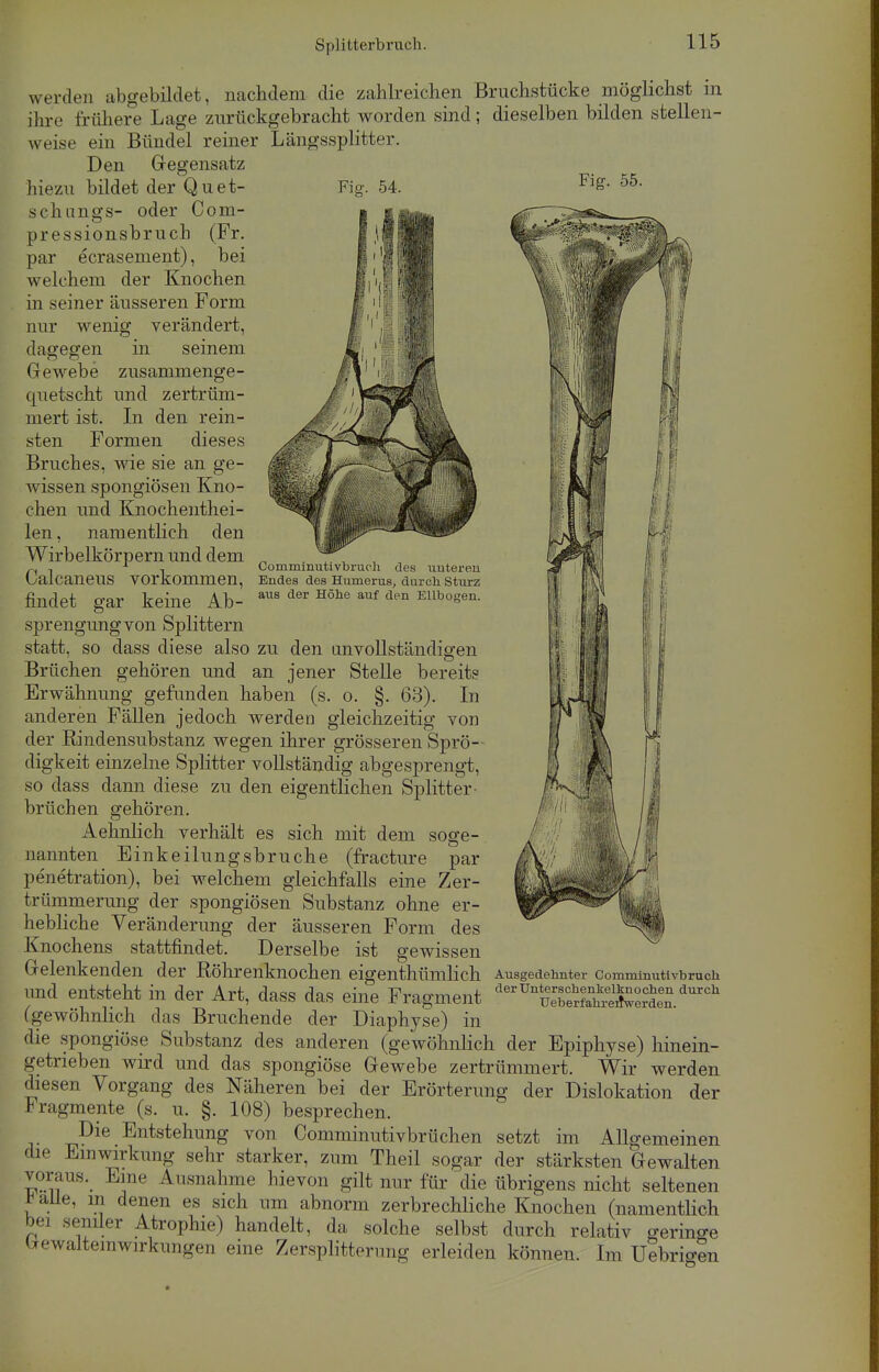 Fig. 55. werden abgebildet, nachdem die zahlreichen Bruchstücke möglichst in ihre frühere Lage zurückgebracht worden sind; dieselben bilden stellen- weise ein Bündel reiner Längssplitter. Den Gegensatz hiezu bildet der Qu et- Fig. 54. schungs- oder Com- pressionsbruch (Fr. par ecrasement), bei welchem der Knochen in seiner äusseren Form nur wenig verändert, dagegen in seinem Gewebe zusammenge- quetscht und zertrüm- mert ist. In den rein- sten Formen dieses Bruches, wie sie an ge- wissen spongiösen Kno- chen und Knochenthei- len, namentlich den Wirbelkörpern und dem „ , 1 , Commmutivbruch des unteren OalcaneilS Vorkommen, Endes des Humerus, durch Sturz findet gar keine Ab- *™ Höhe auf den Ellbogen. Sprengung von Splittern statt, so dass diese also zu den unvollständigen Brüchen gehören und an jener Stelle bereits Erwähnung gefunden haben (s. o. §. 63). In anderen Fällen jedoch werden gleichzeitig von der Rindensubstanz wegen ihrer grösseren Sprö- digkeit einzelne Splitter vollständig abgesprengt, so dass dann diese zu den eigentlichen Splitter- brüchen gehören. Aehnlich verhält es sich mit dem soge- nannten Einkeilungsbruche (fracture par penetration), bei welchem gleichfalls eine Zer- trümmerung der spongiösen Substanz ohne er- hebliche Veränderung der äusseren Form des Knochens stattfindet. Derselbe ist gewissen Gelenkenden der Röhrenknochen eigentümlich Ausgedehnter Comminutivbruch und entsteht in der Art, dass das eine Fragment dUnKKSS£Ä d™°h (gewöhnlich das Bruchende der Diaphyse) in die spongiöse Substanz des anderen (gewöhnlich der Epiphyse) hinein- getrieben wird und das spongiöse Gewebe zertrümmert. Wir werden diesen Vorgang des Näheren bei der Erörterung der Dislokation der Fragmente (s. u. §. 108) besprechen. Die Entstehung von Comminutivbrüchen setzt im Allgemeinen die Einwirkung sehr starker, zum Theil sogar der stärksten Gewalten voraus. Eine Ausnahme hievon gilt nur für die übrigens nicht seltenen talle, m denen es sich um abnorm zerbrechliche Knochen (namentlich bei seniler Atrophie) handelt, da solche selbst durch relativ geringe ttewaltemwirkungen eine Zersplitterung erleiden können. Im Uebrig?n