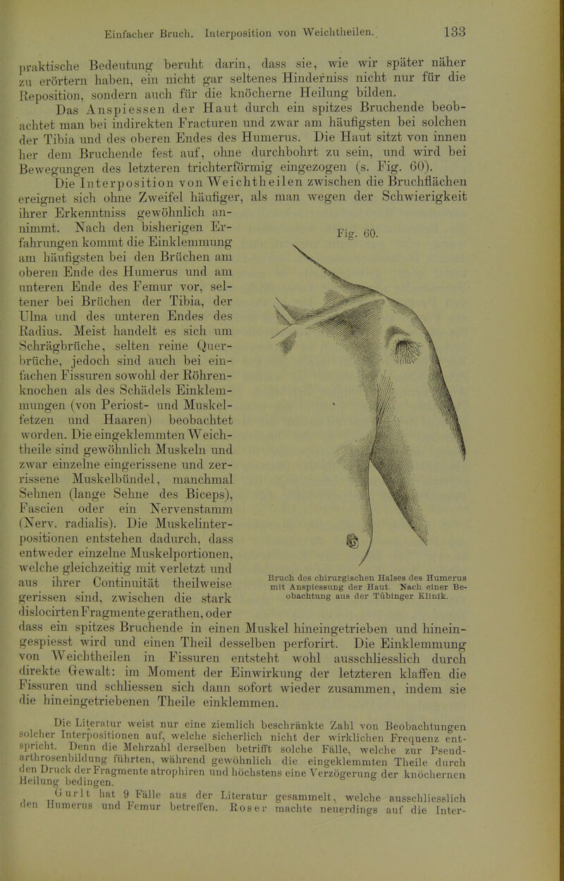 praktische Bedeutung beruht darin, dass sie, wie wir später näher zu erörtern haben, ein nicht gar seltenes Hinderniss nicht nur für die Reposition, sondern auch für die knöcherne Heilung bilden. Das Anspiessen der Haut durch ein spitzes Bruchende beob- achtet man bei indirekten Fracturen und zwar am häufigsten bei solchen der Tibia und des oberen Endes des Humerus. Die Haut sitzt von innen her dem Bruchende fest auf, ohne durchbohrt zu sein, und wird bei Bewegungen des letzteren trichterförmig eingezogen (s. Fig. 60). Die Interposition von Weichtheilen zwischen die Bruchflächen ereignet sich ohne Zweifel häufiger, als man wegen der Schwierigkeit ihrer Erkenntniss gewöhnlich an- Fig. 60. nimmt. Nach den bisherigen Er- fahrungen kommt die Einklemmung am häufigsten bei den Brüchen am oberen Ende des Humerus und am unteren Ende des Femur vor, sel- tener bei Brächen der Tibia, der Ulna und des unteren Endes des Radius. Meist handelt es sich um Schrägbrüche, selten reine Quer- brüche, jedoch sind auch bei ein- fachen Fissuren sowohl der Röhren- knochen als des Schädels Einklem- mungen (von Periost- und Muskel- fetzen und Haaren) beobachtet worden. Die eingeklemmten Weich - theile sind gewöhnlich Muskeln und zwar einzelne eingerissene und zer- rissene Muskelbündel, manchmal Sehnen (lange Sehne des Biceps), Fascien oder ein Nervenstamm (Nerv, radialis). Die Muskelinter- positionen entstehen dadurch, dass entweder einzelne Muskelportionen, welche gleichzeitig mit verletzt und aus ihrer Continuität theilweise gerissen sind, zwischen die stark '1 islocirten Fragmente gerathen, oder dass ein spitzes Bruchende in einen Muskel hineingetrieben und hinein- gespiesst wird und einen Theil desselben perforirt. Die Einklemmung von Weichtheilen in Fissuren entsteht wohl ausschliesslich durch direkte Gewalt: im Moment der Einwirkung der letzteren klaffen die Fissuren und schliessen sich dann sofort wieder zusammen, indem sie die hineingetriebenen Theile einklemmen. Die Literatur weist nur eine ziemlich beschränkte Zahl von Beobachtungen solcher Interpositionen auf, welche sicherlich nicht der wirklichen Frequenz ent- spricht. Denn die Mehrzahl derselben betrifft solche Fälle, welche zur Pseud- arthrosenbildung führten, während gewöhnlich die eingeklemmten Theile durch den Druck der Fragmente atrophiren und höchstens eine Verzögerung- der knöchernen Heilung bedingen. Gurlt hat 9 Fälle aus der Literatur gesammelt, welche ausschliesslich den Humerus und Femur betreffen. Roser machte neuerdings auf die Inter- Bruch des chirurgischen Halses des Humerus mit Anspiessung der Haut. Nach einer Be- obachtung aus der Tübinger Klinik.