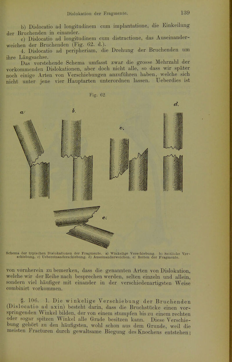 b) Dislocatio ad longitudinem cum implantatione, die Einkeilung der Brachenden in einander. c) Dislocatio ad longitudinem cum distractione, das Auseinander- weichen der Bruchenden (Fig. 62. d.). 4. Dislocatio ad peripheriam, die Drehung der Bruchenden um ihre Längsachse. Das vorstehende Schema umfasst zwar die grosse Mehrzahl der vorkommenden Dislokationen, aber doch nicht alle, so dass wir später noch einige Arten von Verschiebungen anzuführen haben, welche sich nicht unter jene vier Hauptarten unterordnen lassen. Ueberdies ist Fig. 62. Schema der typischen Dislokationen der Fragmente, a) Winkelige Verschiebung, b) Seitliche Ver- schiebung, c) Uebereinanderschiebung. d) Auseinanderweichen, e) Reiten der Fragmente. von vornherein zu bemerken, dass die genannten Arten von Dislokation, welche wir der Reihe nach besprechen werden, selten einzeln und allein, sondern viel häufiger mit einander in der verschiedenartigsten Weise combinirt vorkommen. §. 106. 1. Die winkelige Verschiebung der Bruchenden (Dislocatio ad axin) besteht darin, dass die Bruchstücke einen vor- springenden Winkel bilden, der von einem stumpfen bis zu einem rechten oder sogar spitzen Winkel alle Grrade besitzen kann. Diese Verschie- bung <r,>hört zu den häufigsten, wohl schon aus dem Grunde, weil die meisten Fracturen durch gewaltsame Biegung des Knochens entstehen;