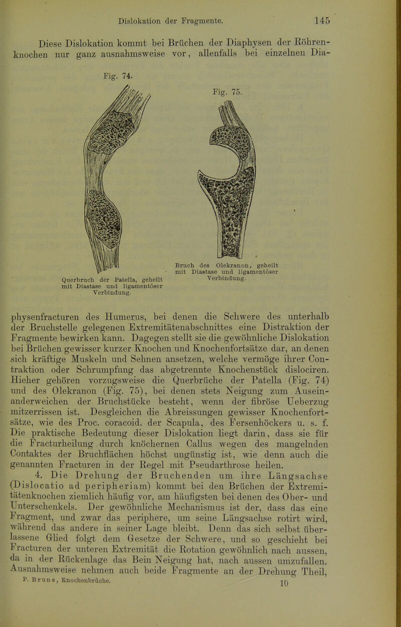 Diese Dislokation kommt bei Brüchen der Diaphysen der Röhren- knochen nur ganz ausnahmsweise vor, allenfalls bei einzelnen Dia- Fig. 74. Querbruch der Patella, geheilt Verbindung, mit Diastase und ligamentöser Verbindung. physenfracturen des Humerus, bei denen die Schwere des unterhalb der Bruchstelle gelegenen Extremitätenabschnittes eine Distraktion der Fragmente bewirken kann. Dagegen stellt sie die gewöhnliche Dislokation bei Brüchen gewisser kurzer Knochen und Knochenfortsätze dar, an denen sich kräftige Muskeln und Sehnen ansetzen, welche vermöge ihrer Con- traktion oder Schrumpfung das abgetrennte Knochenstück dislociren. Hieher gehören vorzugsweise die Querbrüche der Patella (Fig. 74) und des Olekranon (Fig. 75), bei denen stets Neigung zum Ausein- anderweichen der Bruchstücke besteht, wenn der fibröse Ueberzug mitzerrissen ist. Desgleichen die Abreissungen gewisser Knochenfort- sätze, wie des Proc. coracoid. der Scapula, des Fersenhöckers u. s. f. Die praktische Bedeutung dieser Dislokation liegt darin, dass sie für die Fracturheilung durch knöchernen Callus wegen des mangelnden Contaktes der Bruchflächen höchst ungünstig ist, wie denn auch die genannten Fracturen in der Regel mit Pseudarthrose heilen. 4. Die Drehung der Bruchenden um ihre Längsachse (Dislocatio ad peripheriam) kommt bei den Brüchen der Extremi- tätenknochen ziemlich häufig vor, am häufigsten bei denen des Ober- und Unterschenkels. Der gewöhnliche Mechanismus ist der, dass das eine Fragment, und zwar das periphere, um seine Längsachse rotirt wird, während das andere in seiner Lage bleibt. Denn das sich selbst über- lassene Glied folgt dem Gesetze der Schwere, und so geschieht bei Fracturen der unteren Extremität die Rotation gewöhnlich nach aussen, da in der Rückenlage das Bein Neigung hat, nach aussen umzufallen. Ausnahmsweise nehmen auch beide Fragmente an der Drehung Theil, P. Bruns, Knochenbrüche. -in