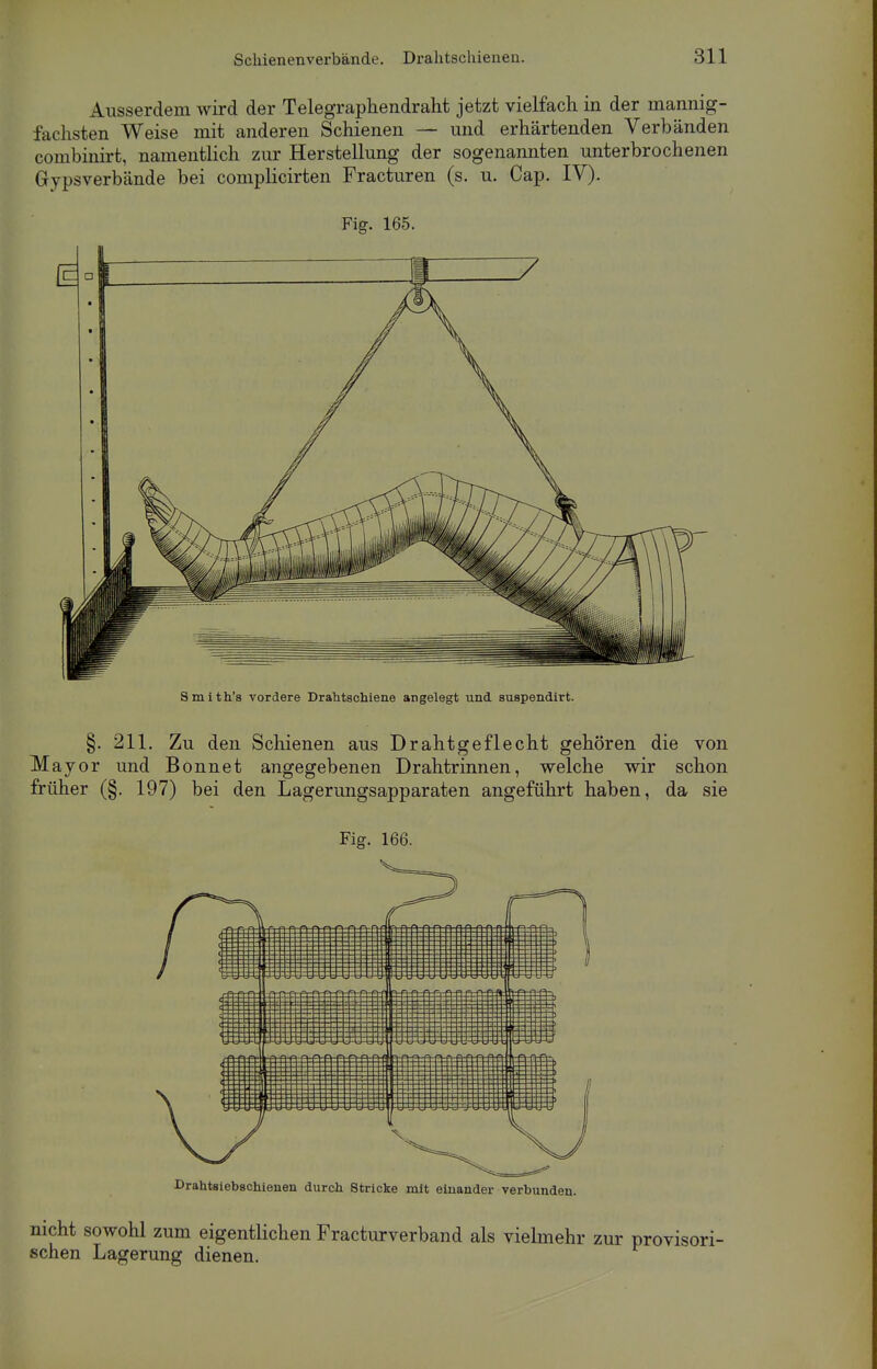 Ausserdem wird der Telegraphendraht jetzt vielfach in der mannig- fachsten Weise mit anderen Schienen — und erhärtenden Verbänden combinirt, namentlich zur Herstellung der sogenannten unterbrochenen Gipsverbände bei complicirten Fracturen (s. u. Cap. IV). Fig. 165. Smith's vordere Drahtschiene angelegt und suspendirt. §. 211. Zu den Schienen aus Drahtgeflecht gehören die von Major und Bonnet angegebenen Drahtrinnen, welche wir schon früher (§. 197) bei den Lagerungsapparaten angeführt haben, da sie Fig. 166. Drahtsiebschienen durch Stricke mit einander verbunden. nicht sowohl zum eigentlichen Fracturverband als vielmehr zur sehen Lagerung dienen.