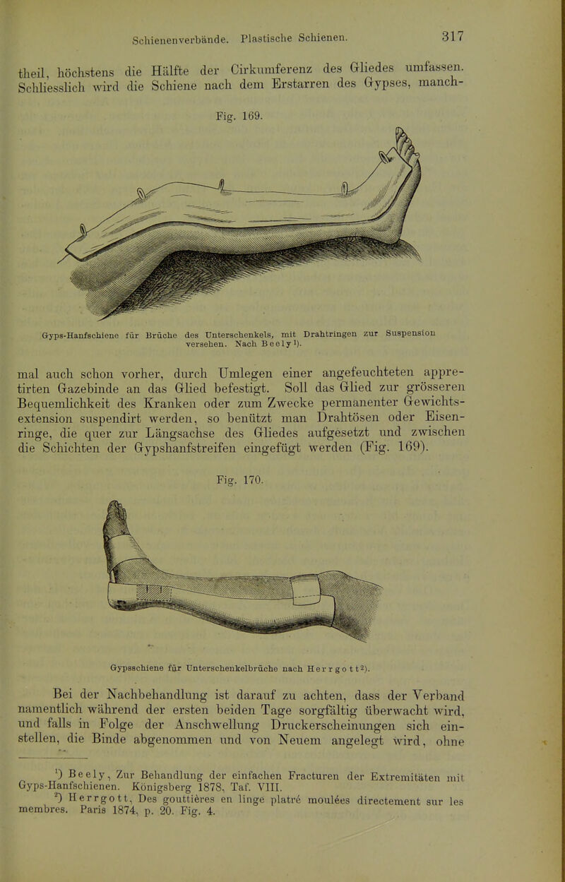 theil, höchstens die Hälfte der Cirkumferenz des Gliedes umfassen. Schliesslich wird die Schiene nach dem Erstarren des Gypses, manch- Fig. 169. Gyps-Hanfschiene für Brüche des Unterschenkels, mit Drahtringen zur Suspension versehen. Nach Beelyi). mal auch schon vorher, durch Umlegen einer angefeuchteten appre- tirten Gazebinde an das Glied befestigt. Soll das Glied zur grösseren Bequemlichkeit des Kranken oder zum Zwecke permanenter Gewichts- extension suspendirt werden, so benützt man Drahtösen oder Eisen- ringe, die quer zur Längsachse des Gliedes aufgesetzt und zwischen die Schichten der Gypshanfstreifen eingefügt werden (Fig. 169). Fig. 170. Gypsschiene für Unterschenkelbrüche nach H e r r g o 112). Bei der Nachbehandlung ist darauf zu achten, dass der Verband namentlich während der ersten beiden Tage sorgfältig überwacht wird, und falls in Folge der Anschwellung Druckerscheinungen sich ein- stellen, die Binde abgenommen und von Neuem angelegt wird, ohne 0 Beely, Zur Behandlung der einfachen Fracturen der Extremitäten mit Gyps-Hanfschienen. Königsberg 1878, Taf. VIII. *) Herrgott, Des gouttieres en linge platre moulees directement sur les membres. Paris 1874, p. 20. Fig. 4.