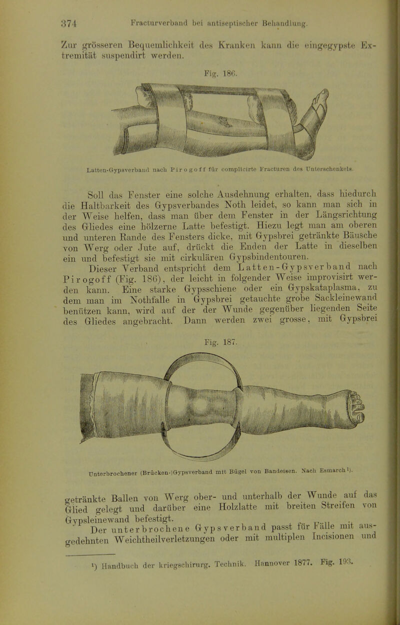 Zur grösseren Bequemlichkeit des Kranken kann die eingegypste Ex- tremität suspendirt werden. Fig. 180. Soll das Fenster eine solche Ausdehnung erhalten, dass hiedurch die Haltbarkeit des Gipsverbandes Noth leidet, so kann man sich in der Weise helfen, dass man über dem Fenster in der Längsrichtung des Gliedes eine hölzerne Latte befestigt. Hiezu legt man am oberen und unteren Rande des Fensters dicke, mit Gypsbrei getränkte Bäusche von Werg oder Jute auf, drückt die Enden der Latte in dieselben ein und befestigt sie mit cirkulären Gypsbindentouren. Dieser Verband entspricht dem Latten-Gypsverband nach Pirogoff (Fig. 186), der leicht in folgender Weise improvisirt wer- den kann. Eine starke Gypsschiene oder ein Gypskataplasma, zu dem man im Nothfalle in Gypsbrei getauchte grobe Sackleinewand benützen kann, wird auf der der Wunde gegenüber liegenden Seite des Gliedes angebracht. Dann werden zwei grosse, mit Gypsbrei Fig. 187. Unterbrochener (Brücken-)Gypsverband mit Bügel von Bandeisen. Nach Esmarchi). getränkte Ballen von Werg ober- und unterhalb der Wunde auf das Glied gelegt und darüber eine Holzlatte mit breiten Streifen von Gypsleinewand befestigt. Der unterbrochene Gypsverband passt für balle mit aus- gedehnten Weichtheilverletzungen oder mit multiplen Incisionen und !) Handbuch der Uriegschirurg. Technik. Hannover 1877. Fig. 193.