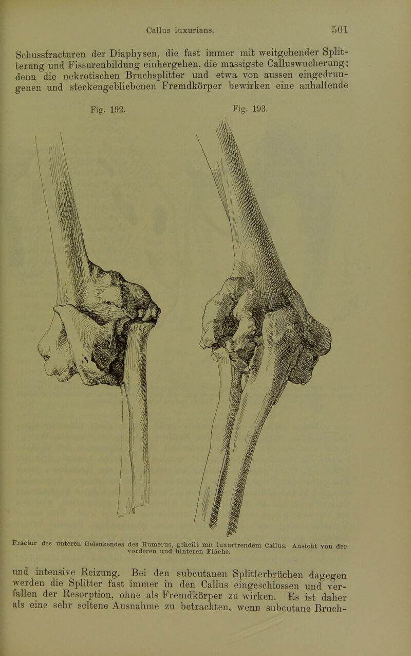 Scbussfracturen der Diaphysen, die fast immer mit weitgehender Split- terimg und Fissurenbildung einhergehen, die massigste Callus Wucherung; denn die nekrotischen Bruchsplitter und etwa von aussen eingedrun- genen und steckengebliebenen Fremdkörper bewirken eine anhaltende Fig. 192. Fig. 193. Fractur des unteren Gelenkendes des Humerus, geheilt mit luxurirendem Callus. Ansicht von der vorderen und hinteren Fläche. und intensive Reizung. Bei den subcutanen Splitterbrüchen dagegen werden die Splitter fast immer in den Callus eingeschlossen und ver- fallen der Resorption, ohne als Fremdkörper zu wirken. Es ist daher als eine sehr seltene Ausnahme zu betrachten, wenn subcutane Bruch-