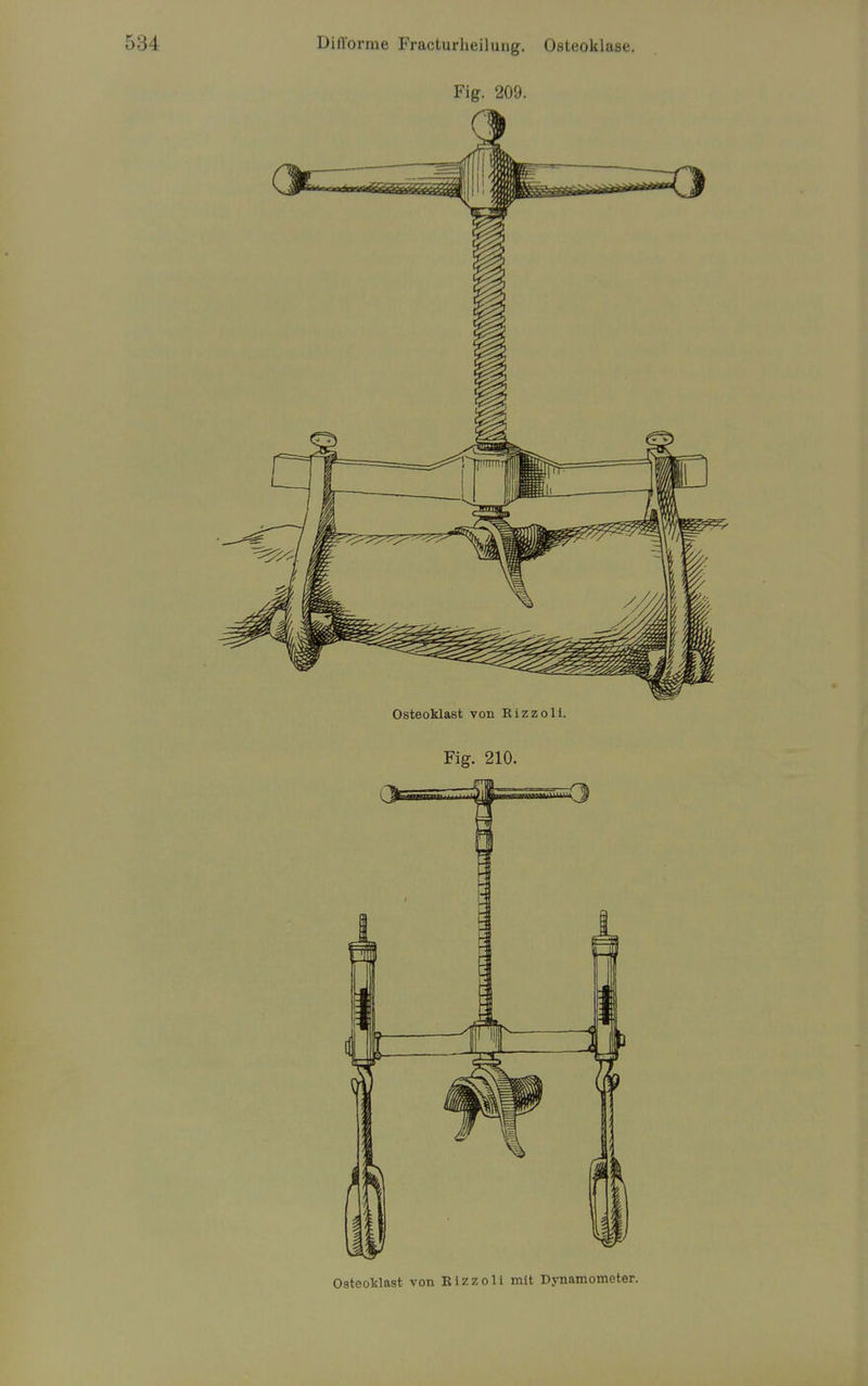 Fig. 209. Osteoklast von Rizzoli. Fig. 210. Osteoklast von Eizzoli mit Dynamometer.