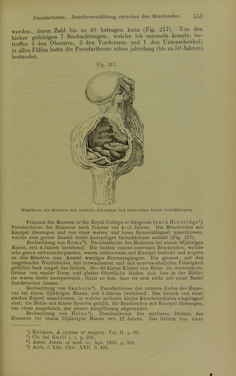 worden, deren Zahl bis zu 40 betragen kann (Fig. 217). Von den hieher o-ehörigen 7 Beobachtungen, welche ich sammeln konnte, be- treffen 4 den Oberarm, 2 den Vorderarm und 1 den Unterschenkel; in allen Fällen hatte die Pseudarthrose schon jahrelang (bis zu 50 Jahren) bestanden. Fig. 217. Nearthrose des Humerus mit Arthritis deformans und zahlreichen freien Gelenkkörpern. Präparat des Museum of the Royal College of Surgeons (nach Hornridge1). Pseudarthrose des Humerus nach Fractur vor 4—5 Jahren. Die Bruchenden mit Knorpel überzogen und von einer weiten und losen Synovialkapsel umschlossen, welche eine grosse Anzahl freier knorpeliger Gelenkkörper enthält (Fig. 217). Beobachtung von Home2). Pseudarthrose des Humerus bei einem 68jährigen Manne, seit 4 Jahren bestehend. Die beiden concav-convexen Bruchenden, welche sehr genau aufeinanderpassten, waren stellenweise mit Knorpel bedeckt und zeigten an den Rändern eine Anzahl warziger Hervorragungen. Ein grosser, mit den umgebenden Weichtheilen fest verwachsener und mit synovia-ähnlicher Flüssigkeit gefüllter Sack umgab das Gelenk. 30—40 kleine Körper von Hirse- bis Gerstenkorn- Grösse von runder Form und glatter Oberfläche fanden sich lose in der Höhle; sie waren theils knorpelweich, theils so fest, dass sie sich nicht mit einer Nadel durchstechen Hessen. Beobachtung von Sanborn3). Pseudarthrose des unteren Endes des Hume- rus bei einem 33jährigen Manne, seit 3 Jahren bestehend. Das Gelenk von einer starken Kapsel umschlossen, in welche mehrere kleine Knochenschalen eingelagert sind; die Höhle mit klarer Synovia gefüllt, die Bruchenden mit Knorpel überzogen, das obere ausgehöhlt, das untere knopfförmig abgerundet. Beobachtung von Heine4)- Pseudarthrose des mittleren Drittels des Humerus bei einem 53jährigen Manne seit 12 Jahren. Das Gelenk von einer 0 Holmes, A System of surgery. Vol. II. p. 80. 2) Cit. bei Gurlt 1. c. p. 591. 3) Amer. Journ. of med. sc. Apr. 1860. p. 339. 4) Arch. f. klin. Chir. XXII. S. 489.