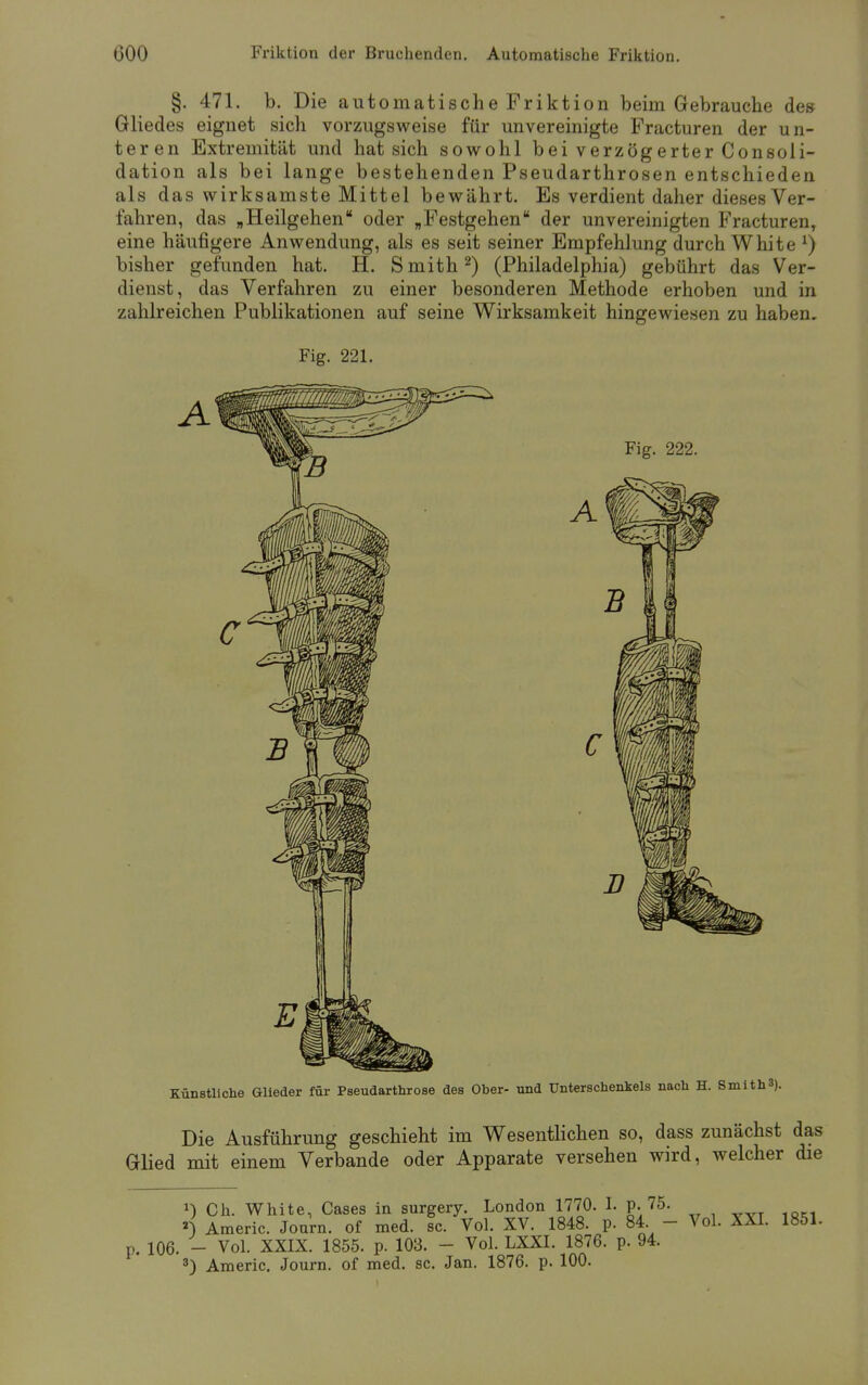 §. 471. b. Die automatische Friktion beim Gebrauche des Gliedes eignet sich vorzugsweise für unvereinigte Fracturen der un- teren Extremität und hat sich sowohl bei verzögerter Consoli- dation als bei lange bestehenden Pseudarthrosen entschieden als das wirksamste Mittel bewährt. Es verdient daher dieses Ver- fahren, das „Heilgehen oder „Festgehen der unvereinigten Fracturen, eine häufigere Anwendung, als es seit seiner Empfehlung durch White x) bisher gefunden hat. H. Smith2) (Philadelphia) gebührt das Ver- dienst, das Verfahren zu einer besonderen Methode erhoben und in zahlreichen Publikationen auf seine Wirksamkeit hingewiesen zu haben. Fig. 221. Künstliche Glieder für Pseudarthrose des Ober- und Unterschenkels nach H. Smith 3). Die Ausführung geschieht im Wesentlichen so, dass zunächst das Glied mit einem Verbände oder Apparate versehen wird, welcher die J) Ch. White, Cases in surgery. London 1770. I. p. 75. «) Americ. Journ. of med. sc. Vol. XV. 1848. p. 84 - Vol. XXI. 1851. p. 106. - Vol. XXIX. 1855. p. 103. - Vol. LXXI. 1876. p. 94. 3) Americ. Journ. of med. sc. Jan. 1876. p. 100.