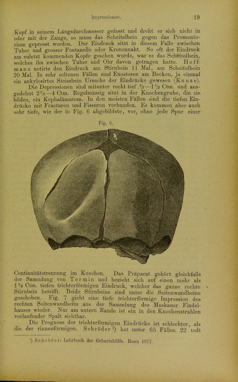 Kopf in seinem Längsdurchmesser gefasst und dreht er sich nicht in oder mit der Zange, so muss das Scheitelbein gegen das Promonto- rium gepresst werden. Der Eindruck sitzt in diesem Falle zwischen Tuber und grosser Fontanelle oder Kronennaht. So oft der Eindruck am zuletzt kommenden Kopfe gesehen wurde, war es das Scheitelbein, welches ihn zwischen Tuber und Ohr davon getragen hatte. Hoff- mann notirte den Eindruck am Stirnbein 11 Mal, am Scheitelbein 20 Mal. In sehr seltenen Fällen sind Exostosen am Becken, ja einmal ein ankylosirtes Steissbein Ursache der Eindrücke gewesen (Kunze). Die Depressionen sind mitunter recht tief .^2—1^2 Ctm. und aus- gedehnt 2V2—4 Ctm. Regelmässig sitzt in der Knochengrube, die sie bilden, ein Kephalämatom. In den meisten Fällen sind die tiefen Ein- drücke mit Fracturen und Fissuren verbunden. Es kommen aber auch sehr tiefe, wie der in Fig. 6 abgebildete, vor, ohne jede Spur einer Fig. 6. Continuitätstrennung im Knochen. Das Präparat gehört gleichfalls der Sammlung von Termin und bezieht sich auf einen mehr als IV2 Ctm. tiefen trichterförmigen Eindruck, welcher das ganze rechte Stirnbein betrifft. Beide Stirnbeine sind unter die Seitenwandbeine geschoben. Fig. 7 giebt eine tiefe trichterförmige Impression des rechten Seitenwandbeins aus der Sammlung des Moskauer Findel- hauses wieder. Nur am untern Rande ist ein in den Knochenstrahlen verlaufender Spalt sichtbar. Die Prognose der trichterförmigen Eindrücke ist schlechter, als die der rinnenförmigen. Schröder^) hat unter 65 Fällen 22 todt