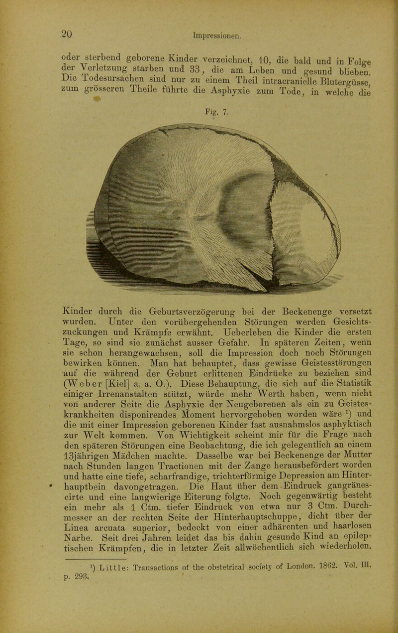 2Ü oder sterbend geborene Kinder verzeichnet, 10, die bald und in Folge der Verletzung starben und 33, die am Leben und gesund blieben Die lodesursachen sind nur zu einem Tlieil intracranielle Blutergüsse zum grösseren Tlieile führte die Asphyxie zum Tode, in welche die Fig. 7. Kinder durch die Geburtsverzögerung bei der Beckenenge versetzt wurden. Unter den vorübergehenden Störungen werden Gesichts- zuckungen und Krämpfe erwähnt. Ueberleben die Kinder die ersten Tage, so sind sie zunächst ausser Gefahr. In späteren Zeiten, wenn sie schon herangewachsen, soll die Impression doch noch Störungen bewirken können. Man hat behauptet, dass gewisse Geistesstörungen auf die v/ährend der Geburt erlittenen Eindrücke zu beziehen sind (Weber [Kiel] a. a. 0.). Diese Behauptung, die sich auf die Statistik einiger Irrenanstalten stützt, würde mehr Werth haben, wenn nicht von anderer Seite die Asphyxie der Neugeborenen als ein zu Geistes- krankheiten disponirendes Moment hervorgehoben worden wäre ^) und die mit einer Impression geborenen Kinder fast ausnahmslos asphyktisch zur Welt kommen. Von Wichtigkeit scheint mir für die Frage nach den späteren Störungen eine Beobachtung, die ich gelegenthch an einem 13jährigen Mädchen machte. Dasselbe war bei Beckenenge der Mutter nach Stunden langen Tractionen mit der Zange herausbefördert worden und hatte eine tiefe, scharfrandige, trichterförmige Depression am Hinter- hauptbein davongetragen. Die Haut über dem Eindruck gangränes- cirte und eine langwierige Eiterung folgte. Noch gegenwärtig besteht ein mehr als 1 Ctm. tiefer Eindruck von etwa nur 3 Ctm. Durch- messer an der rechten Seite der Hinterhauptschuppe, dicht über der Linea arcuata superior, bedeckt von einer adhärenten und haarlosen Narbe. Seit drei Jahren Leidet das bis dahin gesunde Kind an epilep- tischen Krämpfen, die in letzter Zeit allwöchentlich sich wiederholen. ') Little: Transactions of the obstetrical society of London. 1862. Vol. III. 293.