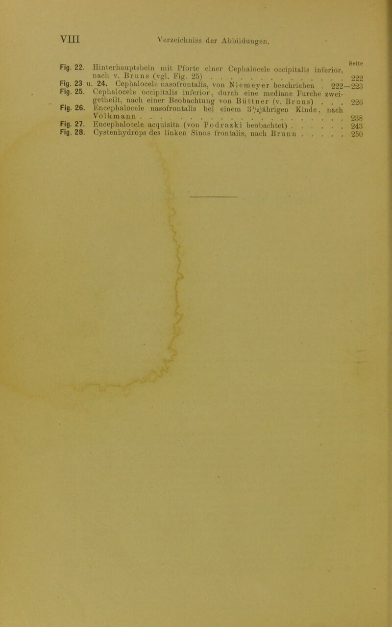 S6it Fig. 22. lliiiterlüiuptsbein mit Pforte einer Cephalocele oecipitalis inferior, nach V. Bruns (vgl. Fig. 25) 22 Fig. 23 u. 24. Cephalocele uasofrontalis, von Niemeyer beschrieben . 222 — 22 Fig. 25. Cephalocele occii)itali.s inferior, durch eine mediane Furche zwei- getheilt, nacli einer J-Jcobachtung von Büttner (v. Bruns) ... 22 Fig. 26. Encephalocele nasofrontalis bei einem 3'/«Jährigen Kinde, nach Volkmann ... ' 23 Fig. 27. Encephalocele acquisita (von Todrazlci beobachtet) 24