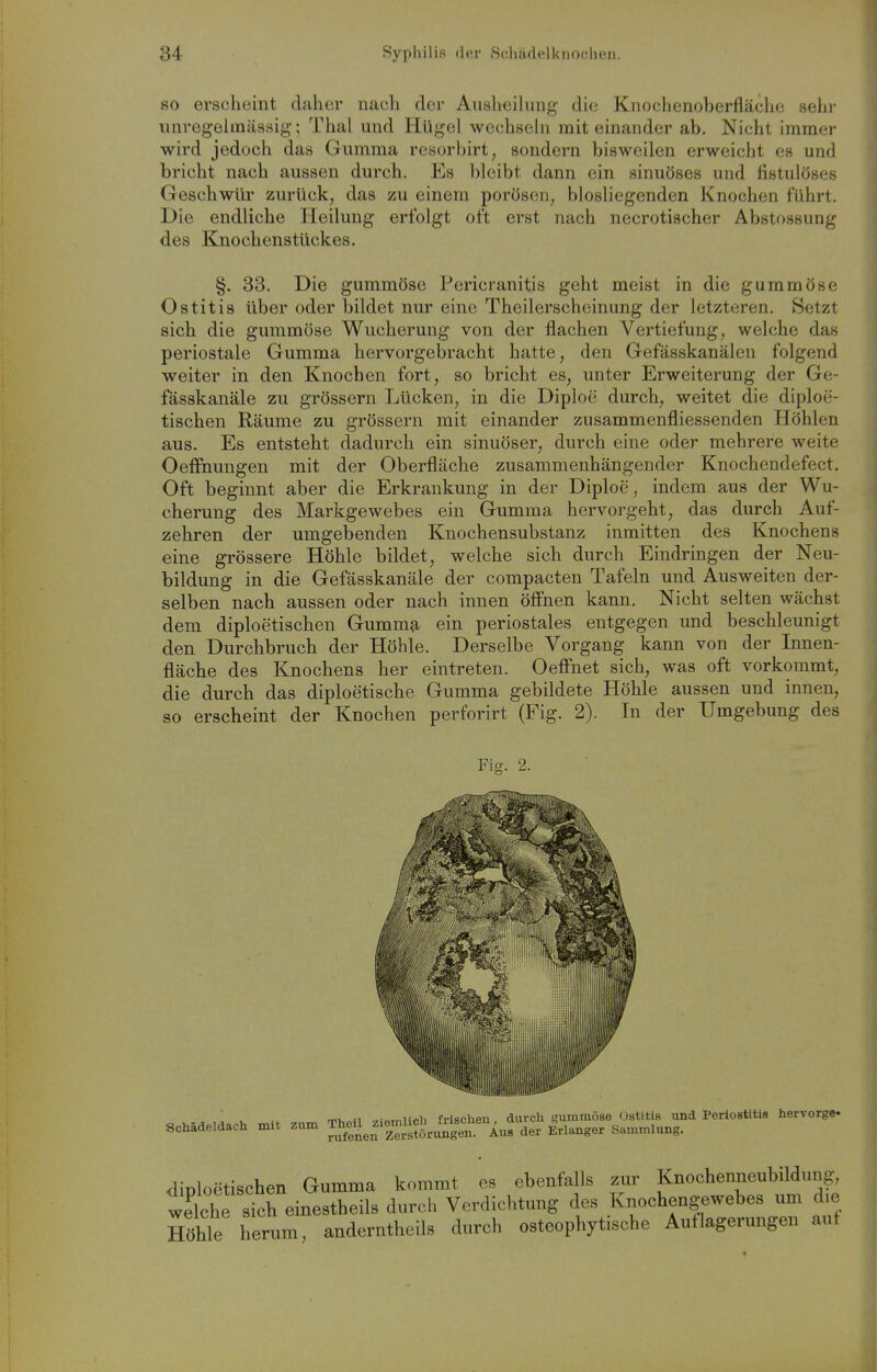 SO erscheint daher nach der Ausheihmg die Knochenoberfläche sehr unregelinässig; Thal und Hügel wechsehi mit einander ab. Nicht immer wird jedoch das Gumma resorbirt, sondern bisweilen erweicht es und bricht nach aussen durch. Es bleibt dann ein sinuöses und fistulöses Geschwür zurück, das zu einem porösen, biosliegenden Knochen führt. Die endliche Heilung erfolgt oft erst nach necrotischer Abstossung des Knochenstückes. §. 33. Die gummöse Pericranitis geht meist in die gummöse Ostitis über oder bildet nur eine Theilerscheinung der letzteren. Setzt sich die gummöse Wucherung von der flachen Vertiefung, welche das periostale Gumma hervorgebracht hatte, den Gefässkanälen folgend weiter in den Knochen fort, so bricht es, unter Erweiterung der Ge- fässkanäle zu grössern Lücken, in die Diploe durch, weitet die diploe- tischen Räume zu grössern mit einander zusammenfliessenden Höhlen aus. Es entsteht dadurch ein sinuöser, durch eine oder mehrere weite OefFnungen mit der Oberfläche zusammenhängender Knochendefect, Oft beginnt aber die Erkrankung in der Diploe, indem aus der Wu- cherung des Markgewebes ein Gumma hervorgeht, das durch Auf- zehren der umgebenden Knochensubstanz inmitten des Knochens eine grössere Höhle bildet, welche sich durch Eindringen der Neu- bildung in die Gefässkanäle der compacten Tafeln und Ausweiten der- selben nach aussen oder nach innen öff'nen kann. Nicht selten wächst dem diploetischen Gumm^, ein periostales entgegen und beschleunigt den Durchbruch der Höhle. Derselbe Vorgang kann von der Innen- fläche des Knochens her eintreten. Oeffnet sich, was oft vorkommt, die durch das diploetische Gumma gebildete Höhle aussen und innen, so erscheint der Knochen perforirt (Fig. 2). In der Umgebung des g. 2. Schädeldach mit zum Tholl Ziemlich frischen, durch gummöse Ostitis und Periostitis hervorge- rufenen Zerstörungen. Aus der Erlanger Sammlung.