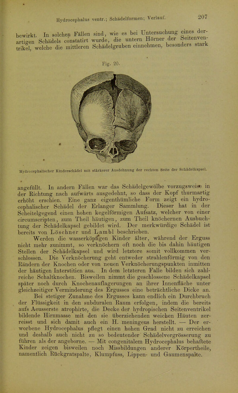 Hydrocephalus ventr.; Schädelformen; Verlauf. bewirkt. In solchen Fällen sind, wie es bei Untersuchung emes der- Sen Schädels constatirt wurde, die untern Hörner der Seitenven- trikel, welche die mittleren Schädelgruben einnehmen, besonders stark Fig. 20. Hydrocephallscher Kinderschädel mit stärkerer Ausdelinung der rechten Seite der Schädelkapsel. angefüllt. In andern Fällen war das Schädelgewölbe vorzugsweise in der Richtung nach aufwärts ausgedehnt, so dass der Kopf thurmartig erhöht erschien. Eine ganz eigenthümliche Form zeigt ein hydro- cephalischer Schädel der Erlanger Sammlung. Dieser hat in der Scheitelgegend einen hohen kegelförmigen Aufsatz, welcher von einer circumscripten, zum Theil häutigen, zum Theil knöchernen Ausbuch- tung der Schädelkapsel gebildet wird. Der merkwürdige Schädel ist bereits von Löschner und Lambl beschrieben. Werden die wasserköpfi'gen Kinder älter, während der Erguss nicht mehr zunimmt, so verknöchern oft noch die bis dahin häutigen Stellen der Schädelkapsel und wird letztere somit vollkommen ver- schlossen. Die Verknöcherung geht entweder strahlenförmig von den Rändern der Knochen oder von neuen Verknöcherungspunkten inmitten der häutigen Interstitien aus. In dem letzteren Falle bilden sich zahl- reiche Schaltknochen. Bisweilen nimmt die geschlossene Schädelkapsel später noch durch Knochenauflagerungen an ihrer Innenfläche unter gleichzeitiger Verminderung des Ergusses eine beträchtliche Dicke an. Bei stetiger Zunahme des Ergusses kann endlich ein Durchbruch der Flüssigkeit in den subduralen Raum erfolgen, indem die bereits aufs Aeusserste atrophirte, die Decke der hydropischen Seiten Ventrikel bildende Hirnmasse mit den sie überziehenden weichen Häuten zer- reisst und sich damit auch ein H. meningeus herstellt. — Der er- worbene Hydrocephalus pflegt einen hohen Grad nicht zu erreichen und deshalb auch nicht zu so bedeutender Schädelvergrösserung zu führen als der angeborne. — Mit congenitalem Hydrocephalus behaftete Kinder zeigen bisweilen noch Missbildungen anderer Körpertheile, namentlich Rückgratspalte, Klumpfuss, Lippen- und Gaumenspalte.