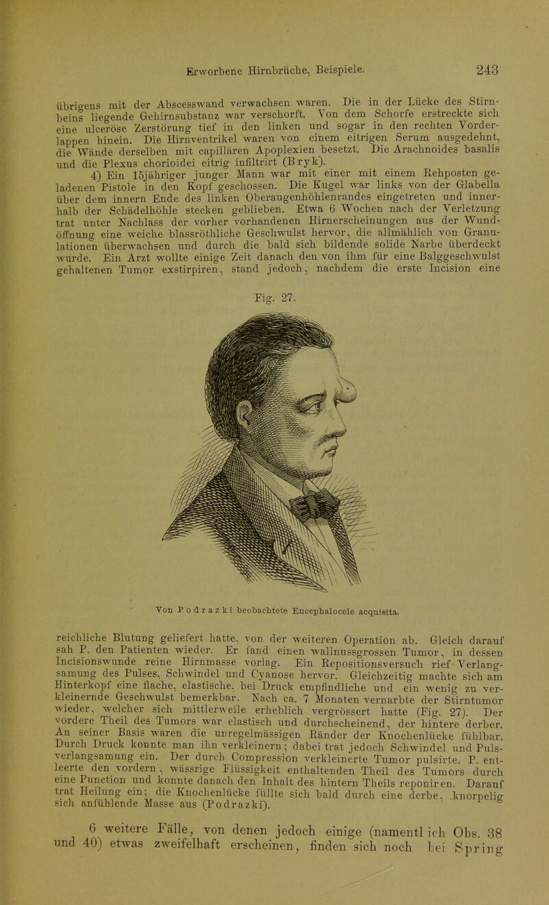 übrigens mit der Abscesswand verwachsen waren. Die in der Lücke des Stirn- beins liegende Gehirnsubstanz war verschorft. Von dem Schorfe erstreckte sich eine ulceröse Zerstörung tief in den linken und sogar in den rechten Vorder- lappen hinein. Die Hirnventrikel waren von einem eitrigen Serum ausgedehnt, die Wände derselben mit capillären Apoplexien besetzt. Die Arachnoides basalis und die Plexus chorioidei eitrig infiltrirt (Bryk). 4) Ein 15jähriger junger Mann war mit einer mit einem Rehposten ge- ladenen Pistole in den Kopf geschossen. Die Kugel war links von der Glabella über dem innern Ende des linken Oberaugenhöhlenrandes eingetreten und inner- halb der Schädelhöhle stecken geblieben. Etwa 6 Wochen nach der Verletzung trat unter Nachlass der vorher vorhandenen Hirnerscheinungen aus der Wund- öffnung eine weiche blassröthliche Geschwulst hervor, die allmählich von Granu- lationen überwachsen und durch die bald sich bildende solide Narbe überdeckt wurde. Ein Arzt wollte einige Zeit danach den von ihm für eine Balggeschwulst gehaltenen Tumor exstirpiren, stand jedoch, nachdem die erste Incision eine reichliche Blutung geliefert hatte, von der weiteren Operation ab. Gleich darauf sah P. den Patienten wieder. Er fand einen -wallnussgrossen Tumor, in dessen Incisionswiinde reine Hirnmasse vorlag. Ein Repositionsversuch rief Verlang- samung des Pulses, Schwindel und Cyanose hervor. Gleichzeitig machte sich am Hinterkopf eine flache, elastische, bei Druck empfindliche und ein wenig zu ver- kleinernde Geschwulst bemerkbar. Nach ca. 7 Monaten vernarbte der Stirntumor wieder, welcher sich mittlerweile erheblich vergrössert hatte (Fig. 27). Der vordere Theil des Tumors war elastisch und durchscheinend, der hintere derber. An seiner Basis waren die unregelmässigen Ränder der Knochenlücke fühlbar. Durch Druck konnte man ihn verkleinern; dabei trat jedoch Schwindel und Puls- verlangsamung em. Der durch Compression verkleinerte Tumor pulsirte. P ent- leerte den vordem , wässrige Flüssigkeit enthaltenden Theil des Tumors durch eine Function und konnte danach den Inhalt des hintern Theils reponiren Darauf trat Heilung ein; die Knochenlücke füllte sich bald durch eine derbe, knorpeliff sich anfühlende Masse aus (Podrazki). 6 weitere Fälle, von denen jedoch einige (namentlich Obs. 88 und 40) etwas zweifelhaft erscheinen, finden sich noch bei Spring- Fig. 27. Von P o ü r a z k 1 beobachtete Encephalocele acquisita.