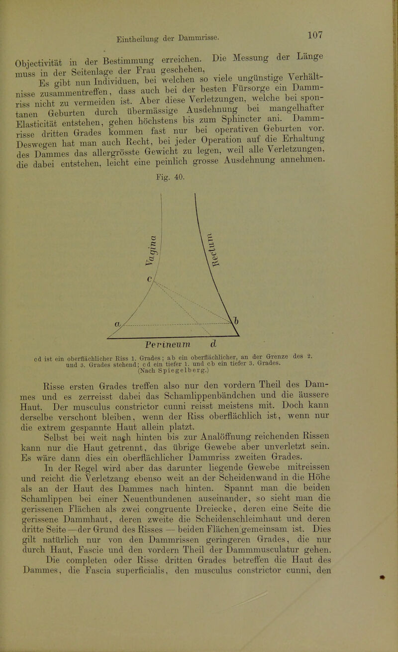 Eintheilung der Damim-isse. Obiectmtät in der Bestimmung erreichen. Die Messung der Länge muss in der Seitenlage der Frau geschehen, Es gibt nun Individuen, bei welchen so viele ungunstige Verhalt- nisse zusammentreffen, dass auch bei der besten Fürsorge em Damm- rSs nidiTzu vermeiden ist. Aber diese Verletzungen, welche bei spon- tanen Geburten durch übermässige Ausdehnung bei mangehafter Elasticität entstehen, gehen höchstens bis zum Sphmcter am. Damm- risse dritten Grades kommen fast nur bei operativen Geburten vor. Deswegen hat man auch Recht, bei jeder Operation auf die Erhaltung des Dammes das allergrösste Gewicht zu legen, wei alle Verletzungen, die dabei entstehen, leicht eine peinKch grosse Ausdehnung annehmen. Fig. 40. cd ist ein oberflächlicher Riss 1. Grades; ah ein oberflächlicher, an der Grenze des 2. und 3. Grades stehend; cd ein tiefer l. und cb ein tiefer 3. Grades. (Nach Spiegelberg.) Risse ersten Grades treffen also nur den vordem Theil des Dam- mes und es zerreisst dabei das Schamlippenbändchen und die äussere Haut. Der musculus constrictor cunni reisst meistens mit. Doch kann derselbe verschont bleiben, wenn der Riss oberflächlich ist, wenn nur die extrem gespannte Haut allein platzt. Selbst bei weit na^h hinten bis zur Analöffnung reichenden Rissen kann nur die Haut getrennt, das übrige Gewebe aber unverletzt sein. Es wäre dann dies ein oberflächlicher Dammriss zweiten Grades. In der Regel wii-d aber das darunter liegende Gewebe mitreissen und reicht die Verletzang ebenso weit an der Scheidenwand in die Höhe als an der Haut des Dammes nach hinten. Spannt man die beiden Schamlippen bei einer Neuentbundenen auseinander, so sieht man die gerissenen Flächen als zwei congruente Dreiecke, deren eine Seite die gerissene Dammhaut, deren zweite die Scheidenschleimhaut und deren dritte Seite —der Grund des Risses — beiden Flächengemeinsam ist. Dies gilt natürlich nur von den Dammrissen geringeren Grades, die nur durch Haut, Fascie und den vordem Theil der Dammmusculatur gehen. Die completen oder Risse dritten Grades betreffen die Haut des Dammes, die Fascia superficialis, den musculus constrictor cunni, den