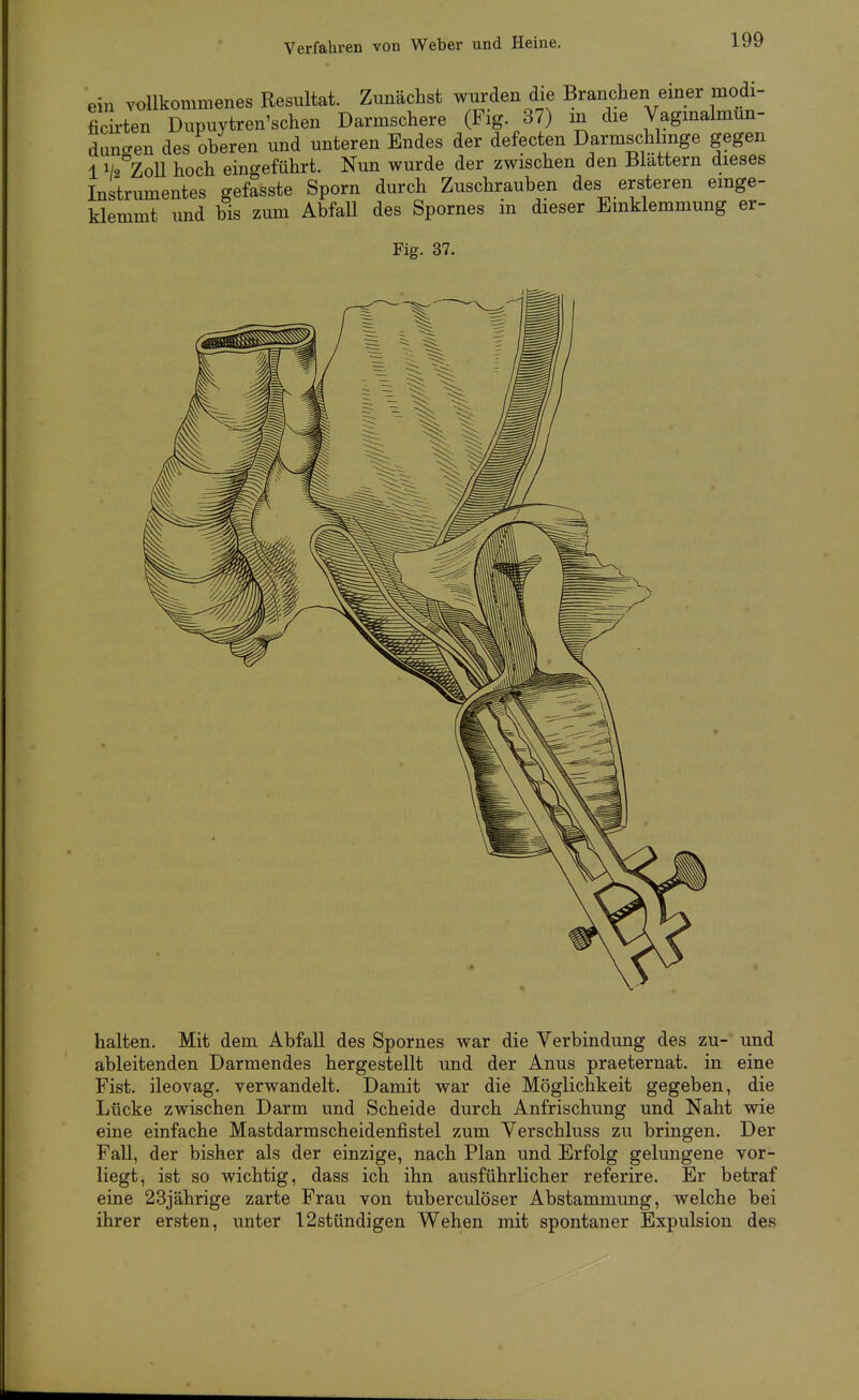 Verfahren von Weber und Heine. ein vollkommenes Resultat. Zunächst wurden die Branchen emer modi- ficrten Dupuytren'sehen Darmschere (Fig 37) in die Vagmalmun- dungen des oberen und unteren Endes der defecten Darmschlinge gegen 11/2 ZoU hoch eingeführt. Nun wurde der zwischen den Blattern dieses Instrumentes gefasste Sporn durch Zuschrauben des ersteren emge- klemmt und bis zum Abfall des Spornes in dieser Einklemmung er- Fig. 37. halten. Mit dem Abfall des Spornes war die Verbindung des zu- und ableitenden Darmendes hergestellt und der Anus praeternat. in eine Fist. ileovag. verwandelt. Damit war die Möglichkeit gegeben, die Lücke zwischen Darm und Scheide durch Anfrischung und Naht wie eine einfache Mastdarmscheidenfistel zum Verschluss zu bringen. Der Fall, der bisher als der einzige, nach Plan und Erfolg gelungene vor- liegt, ist so wichtig, dass ich ihn ausführlicher referire. Er betraf eine 23jährige zarte Frau von tuberculöser Abstammung, welche bei ihrer ersten, unter 12stündigen Wehen mit spontaner Expulsion des