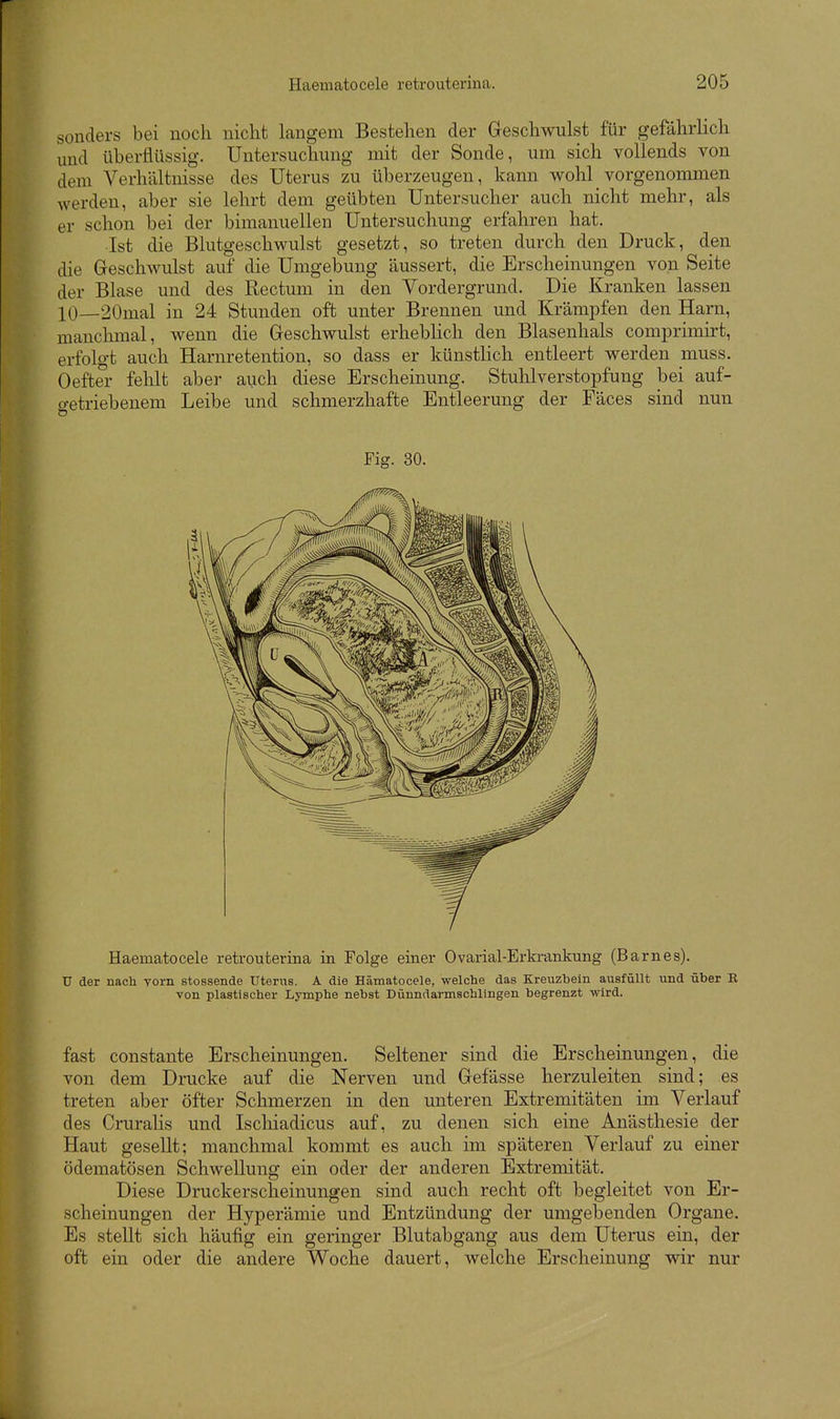 sonders bei noch nicht langem Bestehen der Geschwulst für gefährlich und überflüssig. Untersuchung mit der Sonde, um sich vollends von dem Verhältnisse des Uterus zu überzeugen, kann wohl vorgenommen werden, aber sie lehrt dem geübten Untersucher auch nicht mehr, als er schon bei der bimanuellen Untersuchung erfahren hat. Ist die Blutgeschwulst gesetzt, so treten durch den Druck, den die Geschwulst auf die Umgebung äussert, die Erscheinungen von Seite der Blase und des Rectum in den Vordergrund. Die Kranken lassen 10—20mal in 24 Stunden oft unter Brennen und Krämpfen den Harn, manchmal, wenn die Geschwulst erhebhch den Blasenhals comprimirt, erfolgt auch Harnretention, so dass er künstlich entleert werden muss. Oefter fehlt aber auch diese Erscheinung. Stuhlverstopfung bei auf- o-etriebenem Leibe und schmerzhafte Entleerung der Fäces sind nun Fig. 30. Haematocele retrouterina in Folge einer Ovarial-Erkrankung (Barnes). U der nach vorn stossende Uteriis. A die Hämatocele, welche das Kreuzbein ausfüllt und über R von plastischer Lymphe nebst Dünndarmschlingen begrenzt wird. fast constante Erscheinungen. Seltener sind die Erscheinungen, die von dem Drucke auf die Nerven und Gefässe herzuleiten sind; es treten aber öfter Schmerzen in den unteren Extremitäten im Verlauf des Cruralis und Iscliiadicus auf, zu denen sich eine Anästhesie der Haut gesellt; manchmal kommt es auch im späteren Verlauf zu einer ödematösen Schwellung ein oder der anderen Extremität. Diese Druckerscheinungen sind auch recht oft begleitet von Er- scheinungen der Hyperämie und Entzündung der umgebenden Organe. Es stellt sich häufig ein geringer Blutabgang aus dem Uterus ein, der oft ein oder die andere Woche dauert, welche Erscheinung wir nur