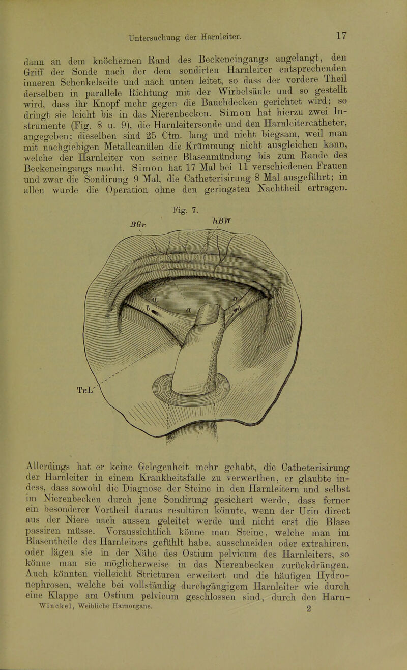 dann an dem knöchernen Rand des Beckeneingangs angelangt, den Griff der Sonde nach der dem sondirten Harnleiter entsprechenden inneren Schenkelseite und nach unten leitet, so dass der vordere Theil derselben in parallele Richtung mit der Wirbelsäule und so gestellt wird, dass ihr Knopf mehr gegen die Bauchdecken gerichtet wird; so dringt sie leicht bis in das Nierenbecken. Simon hat hierzu zwei In- strumente (Fig. 8 u. 9), die Harnleitersonde und den Harnleitercatheter, angegeben; dieselben sind 25 Ctm. lang und nicht biegsam, weil man mit nachgiebigen Metallcanülen die Krümmung nicht ausgleichen kann, welche der Harnleiter von seiner Blasenmündung bis zum Rande des Beckeneingangs macht. Simon hat 17 Mal bei 11 verschiedenen Frauen und zwar die Sondirung 9 Mal, die Catheterisirung 8 Mal ausgeführt; m allen wurde die Operation ohne den geringsten Nachtheil ertragen. Fig. 7. BGr. TiBW TrL Allerdings hat er keine Grelegenheit mehr gehabt, die Catheterisirung der Harnleiter in einem Krankheitsfalle zu verwerthen, er glaubte in- dess, dass sowohl die Diagnose der Steine in den Harnleitern und selbst im Nierenbecken durch jene Sondirung gesichert werde, dass ferner ein besonderer Vortheil daraus resultiren könnte, wenn der Urin direct aus der Niere nach aussen geleitet werde und nicht erst die Blase passiren müsse. Voraussichtlich könne man Steine, welche man im Blasentheile des Harnleiters gefühlt habe, ausschneiden oder extrahiren, oder lägen sie in der Nähe des Ostium pelvicum des Harnleiters, so könne man sie möglicherweise in das Nierenbecken zurückdrängen. Auch könnten vielleicht Stricturen erweitert und die häufigen Hydro- nephrosen, welche bei vollständig durchgängigem Harnleiter wie durch eine Klappe am Ostium pelvicum geschlossen sind, durch den Harn- W in ekel, Weibliche Haniorgane. 2