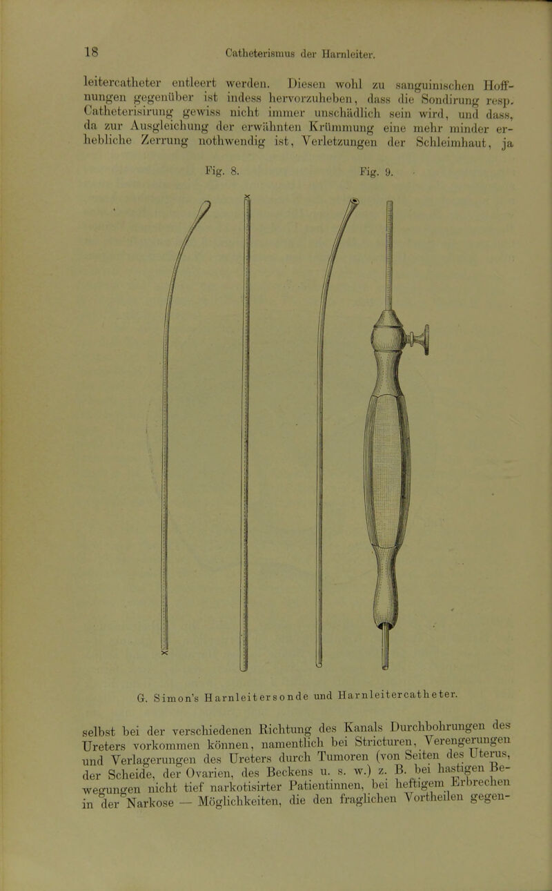 leitercatheter entleert werden. Diesen wohl zu sanguinischen Hofi- nung-en gegenüber ist indess hervorzuheben, dass die Sondirung resp, Catheterisirung gewiss nicht immer unschädlich sein wird, und dass, da zur Ausgleichung der erwilhnten Krümmung eine mehr minder er- hebliche Zerrung nothwendig ist, ^Verletzungen der Schleimhaut, ja Fig. 8. Fig. 9. G. Simon's Harnleitersonde und Harnleitercatheter. selbst bei der verschiedenen Richtung des Kanals Durchbohrungen des Ureters vorkommen können, namentlich bei Stricturen, Verengerungen und Verlagerungen des Ureters durch Tumoren (von Seiten des Uterus, der Scheide, der Ovarien, des Beckens u. s. w.) z. B. bei hastigen Be- weffunaen nicht tief narkotisirter Patientinnen, bei heftigem H^rbrechen in der Narkose - Möglichkeiten, die den fraglichen Vortheilen gegen-
