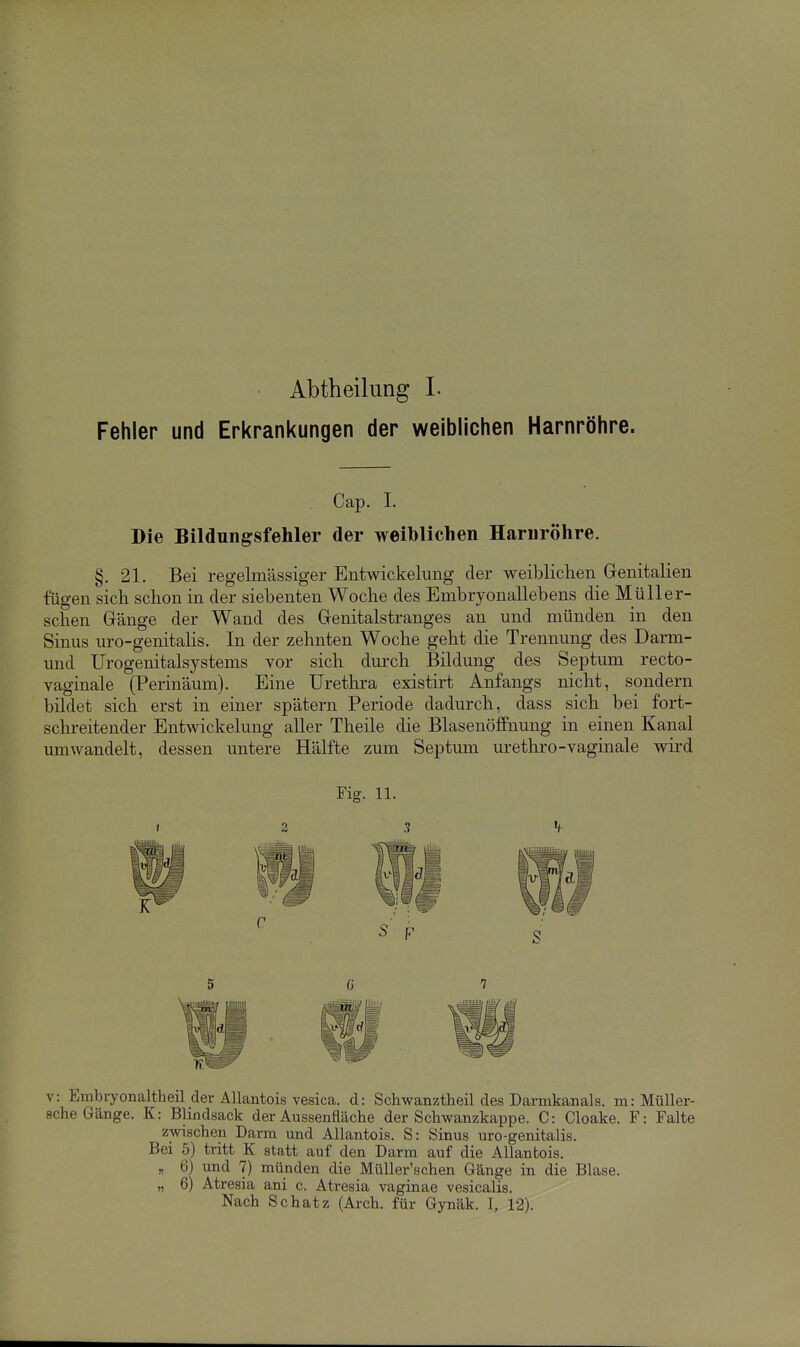 Abtheilung L Fehler und Erkrankungen der weiblichen Harnröhre. Cap. I. Die Bildungsfehler der weiblichen Harnröhre. §. 21. Bei regelmässiger Entwickelung der weiblichen Genitalien fügen sicli sclion in der siebenten Woche des Embryonallebens die M üll er- sehen Gänge der Wand des Genitalstranges an und münden in den Sinus uro-genitalis. In der zehnten Woche geht die Trennung des Darm- und Urogenitalsystems vor sich durch Bildung des Septum recto- vaginale (Perinäum). Eine Urethra existirt Anfangs nicht, sondern bildet sich erst in einer spätem Periode dadurch, dass sich bei fort- schreitender Entwickelung aller Theile die Blasenöffnung in einen Kanal umwandelt, dessen untere Hälfte zum Septum urethro-vaginale wird Fig. 11. r v: Embiyonaltheil der Allantois vesica. d: Schwanztheil des Darmkanals. m: MüUer- sche Gänge. K: Blindsack der Aussenfläche der Schwanzkappe. C: Cloake. F: Falte zwischen Darm und Allantois. S: Sinus uro-genitalis. Bei 5) tritt K statt auf den Darm auf die Allantois. „ 6) und 7) münden die Müller'schen Gänge in die Blase. „ 6) Atresia ani c. Atresia vaginae vesicalis. Nach Schatz (Arch. für Gynäk. I, 12).