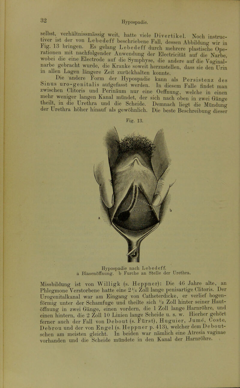 Hypospadie. selbst, verhältnissmässig weit, hatte viele Divertikel. Noch instruc- tiver ist der von Lebedeff beschriebene Fall, dessen Abbilduni. wir in Flg. 13 bringen. Es gelang Lebedeff durch mehrere plastisdie Ope- rationen mit nachfolgender Anwendung der Electricität auf die Narbe wobei die eine Electrode auf die Symphyse, die andere auf die Vaginal- narbe gebracht wurde, die Kranke soweit herzustellen, dass sie den Urin in allen Lagen längere Zeit zurückhalten konnte. Die -andere Form der Hypospadie kann als Persistenz des binus uro-genitalis aufgefasst werden. In diesem Falle findet man zwischen Clitoris und Perinäum nur eine Oeffnung, welche in einen mehr weniger langen Kanal mündet, der sich nach oben in zwei Gänge theilt, in die Urethra und die Scheide. Demnach hegt die Mündung der Urethra höher hinauf als gewöhnhch. Die beste Beschreibung dieser Fig. 13. Hypospadie nach Lebedeff. a ßlasenöffiiung. b Furche an Stelle der Urethra. Missbildung ist von Willigk (s. Heppner): Die 46 Jahre alte, an Phlegmone Verstorbene hatte eine 2 Zoll lange penisartige Clitoris. Der Urogenitalkanal war am Eingang von Catheterdicke, er verHef bogen- förmig unter der Schamfuge und theilte sich V2 Zoll hinter seiner Haut- öffnung in zwei Gänge, einen vordem, die 1 Zoll lange Harnröhre, und einen hintern, die 2 Zoll 10 Linien lange Scheide u. s. w. Hierher gehört ferner auch der Fall von Debout (s. Fürst), Huguier, Jumd, Coste, Debrou und der von Engel (s. Heppner p. 413), welcher dem Debout- schen am meisten gleicht. In beiden war nämhch eine Atresia vagmae vorhanden und die Scheide mündete in den Kanal der Harnröhre.