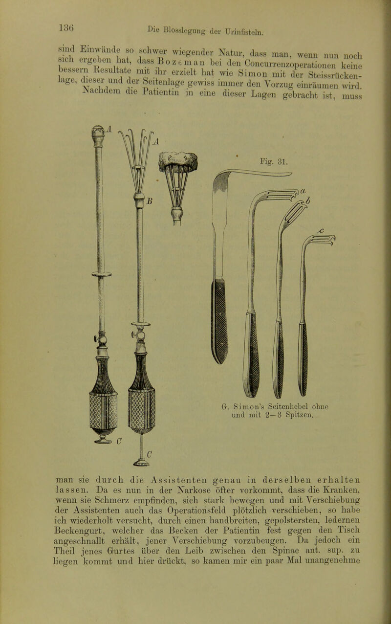 130 Die Blosslegung der Urinfisteln. Sind Einwände so schwer wiegender Natur, dass man, wenn nun noch sich ergeben hat, dass Bozeman bei den Concurrenz;,perationeT kein bessei-n Resultate mi^ ihr erzielt hat wie Simon mit der Steissrückei - lage, dieser und der Seitenlage gewiss immer den Vorzug einräumen wird. Nachdem die Patientin in eine dieser Lagen gebracht ist, mus.s man sie durch die Assistenten genau in derselben erhalten lassen. Da es nun in der Narkose öfter vorkommt, dass die Kranken, wenn sie Schmerz empfinden, sich stark bewegen und mit Verschiebung der Assistenten auch das Operationsfeld plötzHch verschieben, so habe ich wiederholt versucht, durch einen handbreiten, gepolstersteii, ledernen Beckengurt, welcher das Becken der Patientin fest gegen den Tisch angeschnallt erhält, jener Verschiebung vorzubeugen. Da jedoch ein Theil jenes Grurtes über den Leib zwischen den Spinae aut. sup. zu liegen kommt und hier drückt, so kamen mir ein paar Mal unangenehme