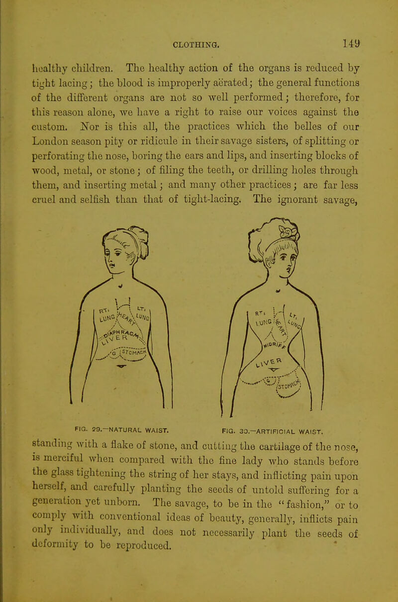lioalthy cliildren. The healthy action of the organs is reduced by tight lacing; the blood is improperly aerated j the general functions of the different organs are not so well performed; therefore, for this reason alone, we have a right to raise our voices against the custom. Nor is this all, the practices which the belles of our London season pity or ridicule in their savage sisters, of splitting or perforating the nose, boring the ears and lips, and inserting blocks of wood, metal, or stone; of filing the teeth, or drilling holes through them, and inserting metal; and many other practices; are far less cruel and selfish than that of tight-lacing. The ignorant savage, standing with a flake of stone, and cutting the cartilage of the nose, is merciful when compared with tlie fine lady who stands before the glass tightening the string of her stays, and inflicting pain upon herself, and carefully planting the seeds of untold sufforing for a generation yet unborn. The savage, to be in the fashion, or to comply with conventional ideas of beauty, generally, inflicts pain only individually, and does not necessarily plant the seeds of deformity to be reproduced. FIG. ff9.—NATURAL WAIST. FIG. 30.—ARTIFICIAL WAIST.