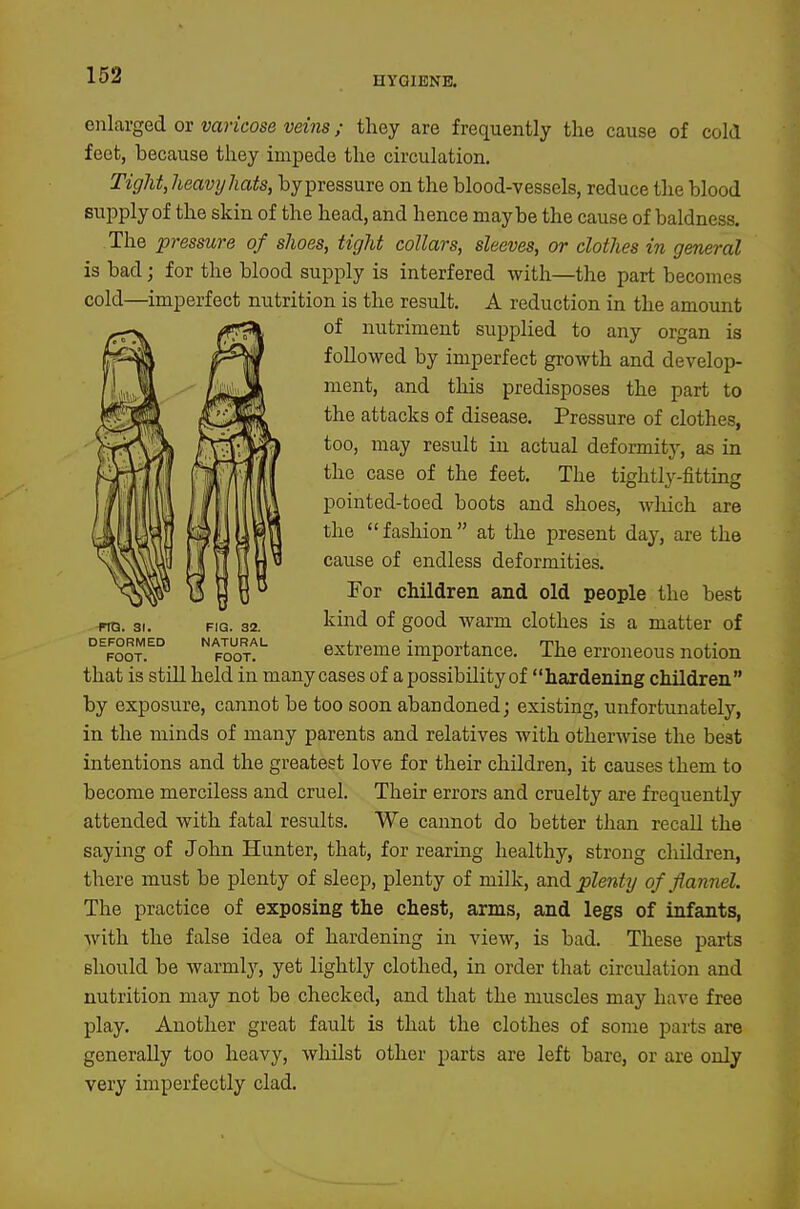 HYGIENE. enldvged ovvaricose veins; tliey are frequently the cause of cold feet, because they impede the circulation. Tight, heavyliats, bypressure on the blood-vessels, reduce the blood supply of the skin of the head, and hence maybe the cause of baldness. The pressure of shoes, tight collars, sleeves, or clothes in general is bad; for the blood supply is interfered with—the part becomes cold—imperfect nutrition is the result. A reduction in the amount of nutriment supplied to any organ is followed by imperfect growth and develop- ment, and this predisposes the part to the attacks of disease. Pressure of clothes, too, may result in actual deformity, as in the case of the feet. The tightly-fitting pointed-toed boots and shoes, which are the  fashion at the present day, are the cause of endless deformities. For children and old people the best kind of good warm clothes is a matter of extreme importance. The erroneous notion that is stUl held in many cases of a possibility of hardening children by exposure, cannot be too soon abandoned; existing, unfortunately, in the minds of many parents and relatives with otherwise the best intentions and the greatest love for their children, it causes them to become merciless and cruel. Their errors and cruelty are frequently attended with fatal results. We cannot do better than recall the saying of John Hunter, that, for rearing healthy, strong children, there must be plenty of sleep, plenty of milk, and plenty of flannel. The practice of exposing the chest, arms, and legs of infants, with the false idea of hardening in view, is bad. These parts should be warmly, yet lightly clothed, in order that circulation and nutrition may not be checked, and that the muscles may have free play. Another great fault is that the clothes of some parts are generally too heavy, whUst other parts are left bare, or are only very imperfectly clad. rtD. 31. DEFORMED FOOT