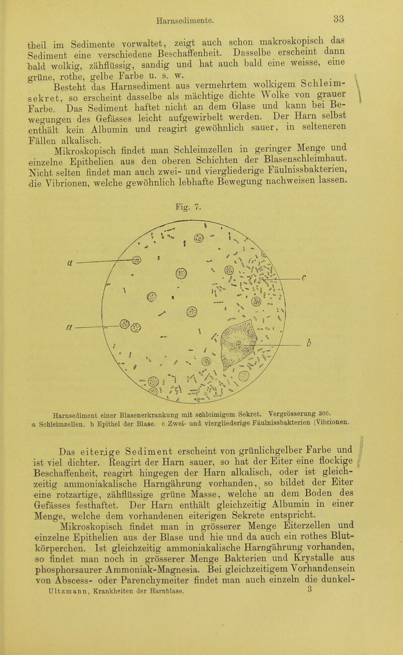 theil im Sedimente vorwaltet, zeigt auch schon makroskopisch das Sediment eine verschiedene Beschaffenheit. Dasselbe erscheint dann bald wolkig, zähflüssig, sandig und hat auch bald eine weisse, eine grüne, rothe, gelbe Farbe u. s. w. . Besteht das Harnsediment aus vermehrtem wolkigem bcnleim- sekret, so erscheint dasselbe als mächtige dichte Wolke von grauer Farbe. Das Sediment haftet nicht an dem Glase und kann bei Be- wegungen des Gefässes leicbt aufgewirbelt werden. Der Harn selbst enthält kein Albumin und reagirt gewöhnlich sauer, in selteneren Fällen alkaliscb. Mikroskopisch findet man Schleimzellen in geringer Menge und einzelne Epithelien aus den oberen Schichten der Blasenschleimhaut. Nicht selten findet man auch zwei- und viergliederige Fäulnissbaktenen, die Vibrionen, welche gewöhnlich lebhafte Bewegung nachweisen lassen. Fig. 7. Harnsediment einer Blasenerkrankung mit schleimigem Sekret. Vergrösserung 300. a Schleimzellen, b Epithel der Blase, c Zwei- und viergliederige Fäulnissbakterien (Vibrionen. Das eiterige Sediment erscheint von grünlichgelber Farbe und ist viel dichter. Reagirt der Harn sauer, so hat der Eiter eine flockige Beschaffenheit, reagirt hingegen der Harn alkalisch, oder ist gleich- zeitig ammoniakalische Harngährung vorhanden^ so bildet der Eiter eine rotzartige, zähflüssige grüne Masse, welche an dem Boden des Gefässes festhaftet. Der Harn enthält gleichzeitig Albumin in einer Menge, welche dem vorhandenen eiterigen Sekrete entspricht. Mikroskopisch findet man in grösserer Menge Eiterzellen und einzelne Epithelien aus der Blase und hie und da auch ein rothes Blut- körperchen. Ist gleichzeitig ammoniakalische Harngährung vorhanden, so findet man noch in grösserer Menge Bakterien und Krystalle aus phosphorsaurer Ammoniak-Magnesia. Bei gleichzeitigem Vorhandensein von Abscess- oder Parenchymeiter findet man auch einzeln die dunkel- Ultzmann, Krankheiten der Harnblase. 3